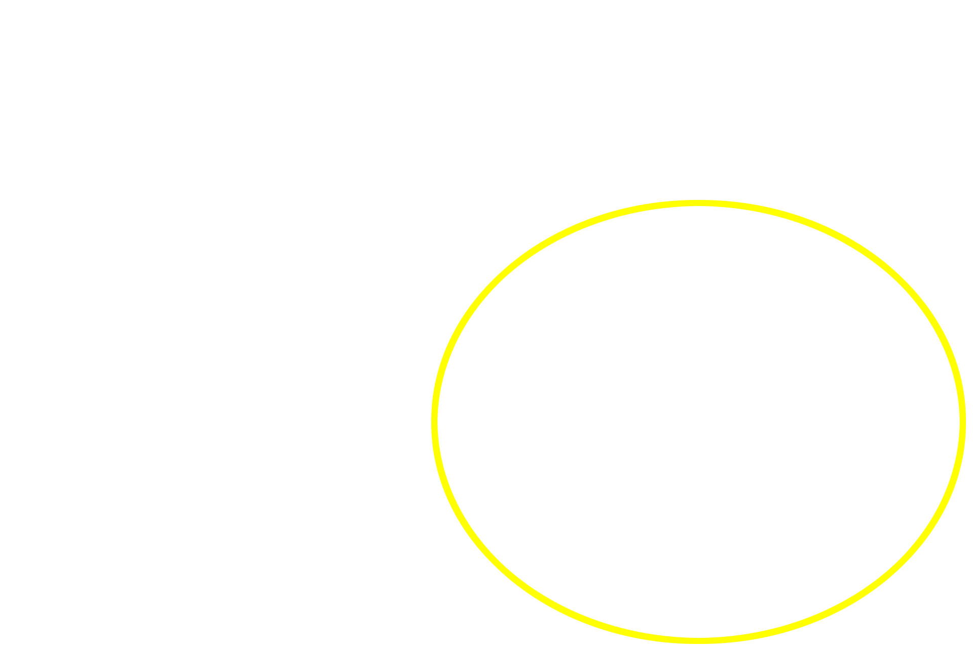 Acinus <p>These secretory cells of the mammary glands in the breast secrete by both the merocrine mode, for the protein component of milk, and the apocrine mode for the lipid components.  Apocrine secretion involves the loss of a small amount of surface plasma membrane and cytoplasm along with the secretory product.  Note the secretory product being released in the lower right of the image.  Apocrine secretion occurs only in mammary glands.  Breast 1000x</p>
