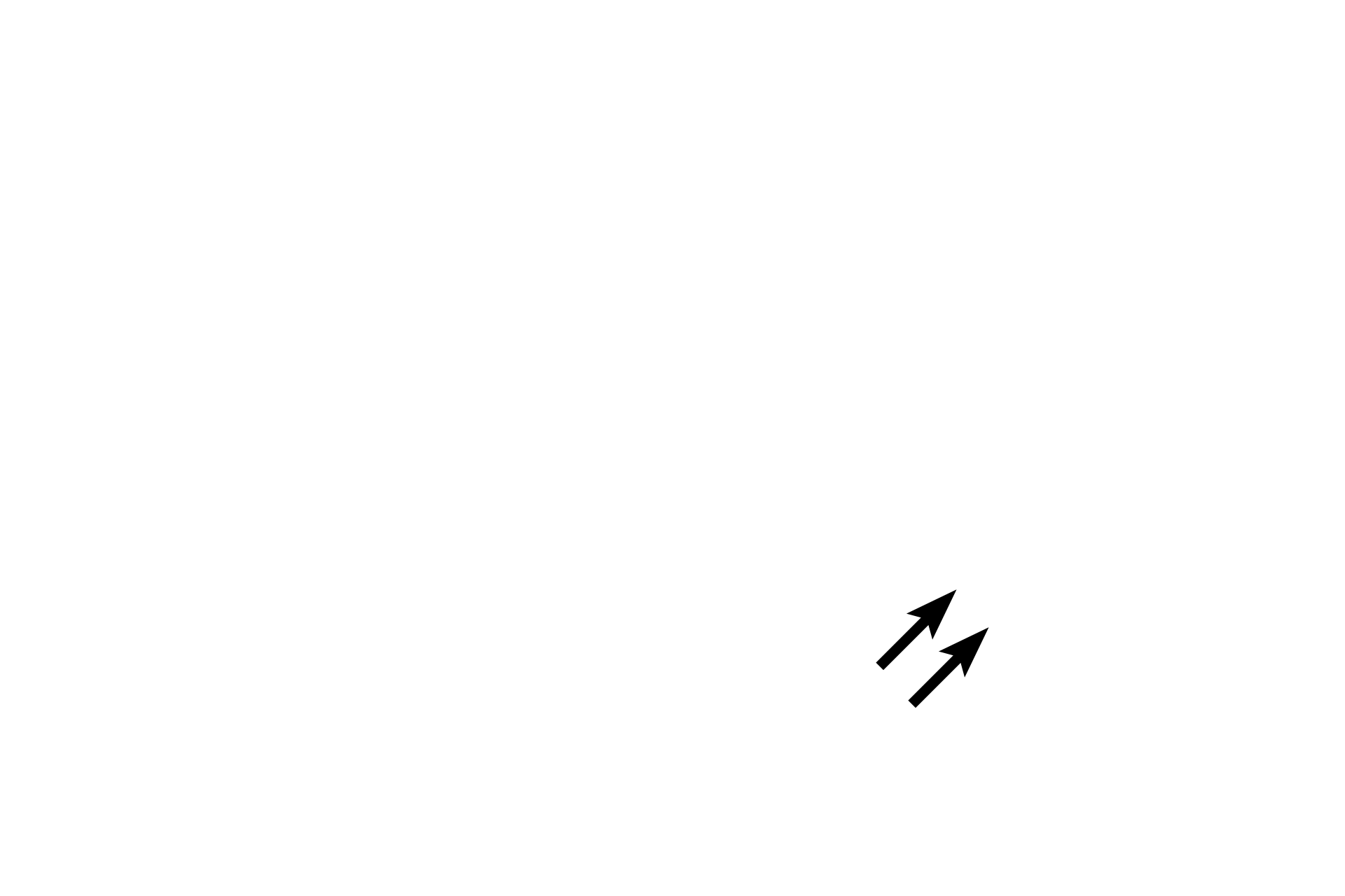Lipid secretory product <p>These secretory cells of the mammary glands in the breast secrete by both the merocrine mode, for the protein component of milk, and the apocrine mode for the lipid components.  Apocrine secretion involves the loss of a small amount of surface plasma membrane and cytoplasm along with the secretory product.  Note the secretory product being released in the lower right of the image.  Apocrine secretion occurs only in mammary glands.  Breast 1000x</p>
