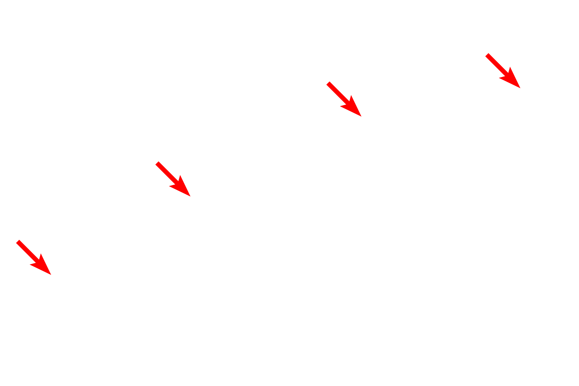Simple squamous epithelial cell <p>All epithelia rest on a basement membrane, which consists of two components, the basal lamina, secreted by epithelial cells, and a reticular lamina, secreted by fibroblasts in the underlying connective tissue.  The basal lamina is, in turn, subdivided into lamina lucida and lamina densa.  Additional studies have shown that the presence of the lamina lucida results from a fixation-shrinkage artifact of the tissue.  The clear space does not exist in life and thus the lamina densa lies directly adjacent to the plasma membrane.  Serosa  15,000x</p>
