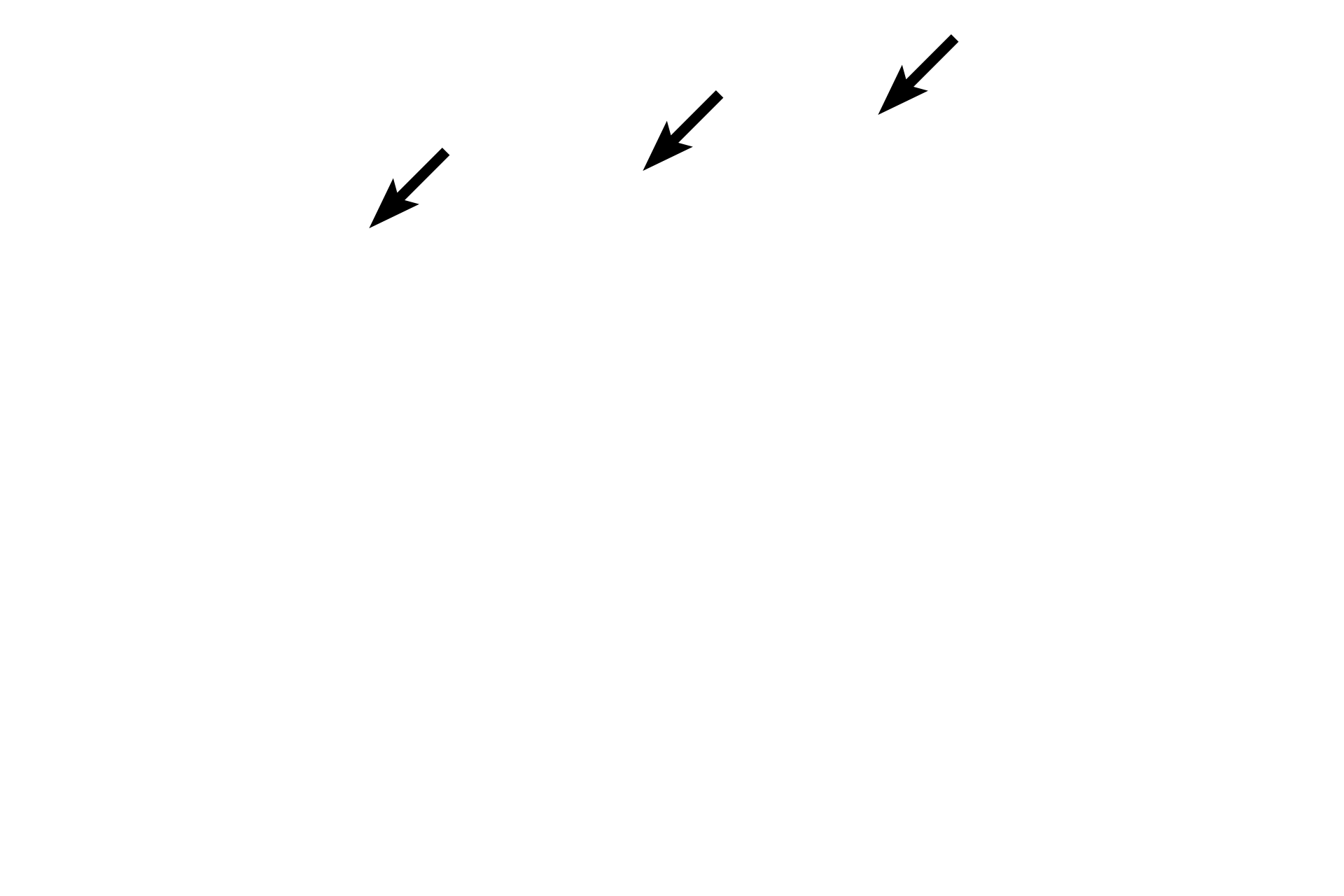 Cilia <p>Much of the epithelium of the respiratory tract possesses cilia.  Inhaled particulate material is captured in a sheet of mucus produced by goblet cells. This mucous sheet is swept upward in the respiratory tract by the action of the cilia.  Each cilium contains a microtubule complex called the axoneme, which emanates from the basal body.  Note the uniquely thick basal lamina of this epithelium.  1000x</p>
