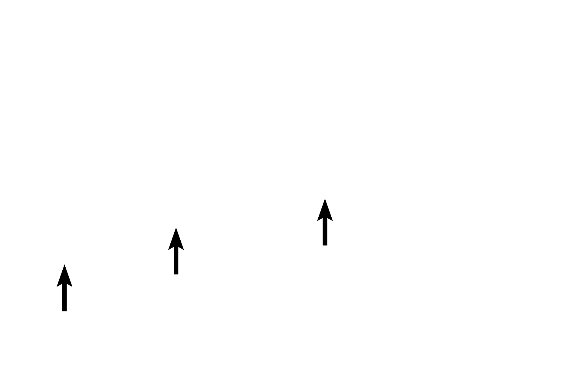 Basement membrane > <p>The basement membrane is more prominent in the respiratory system than in other organ systems.</p>
