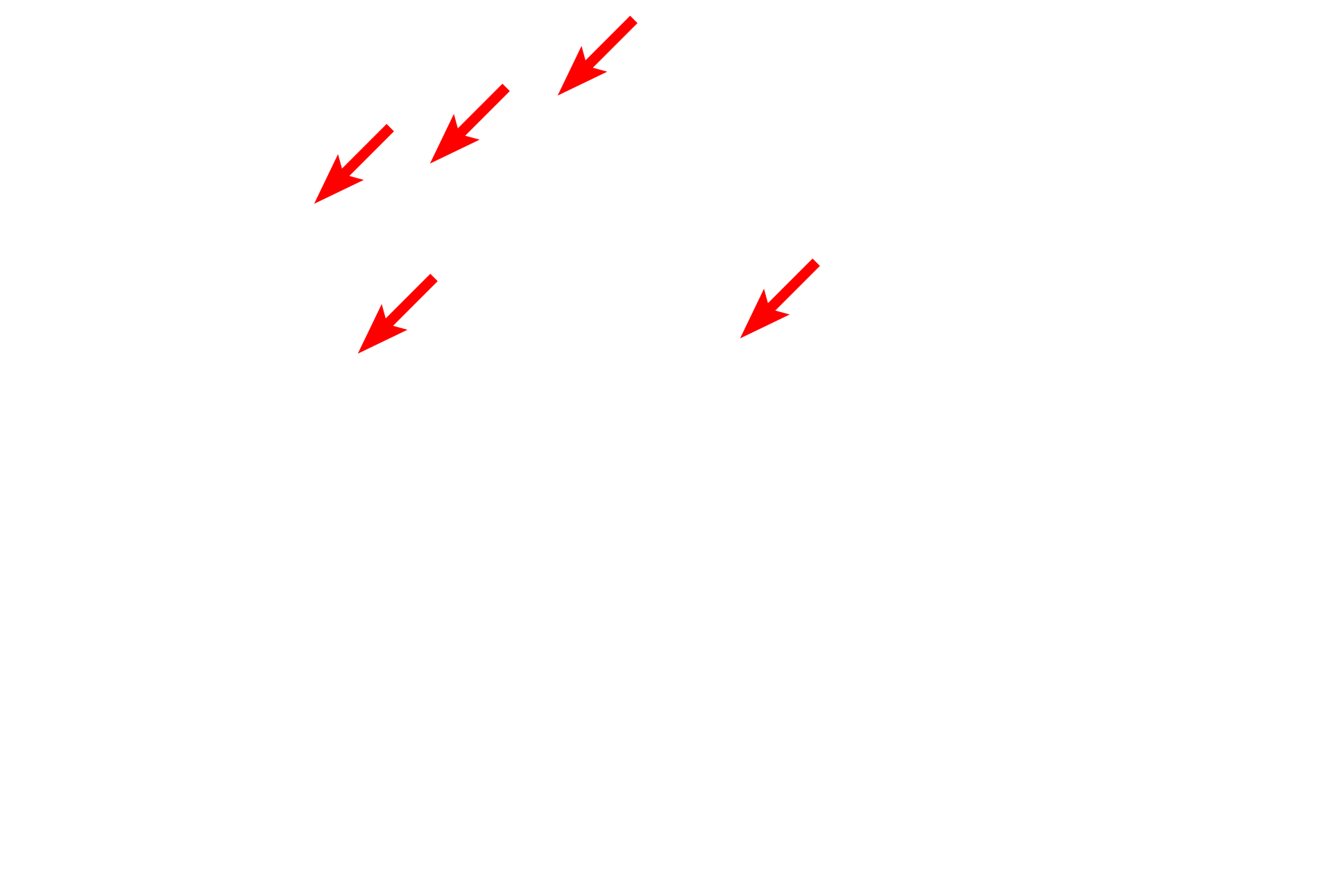  - Inner microtubule pair <p>This higher magnification of cilia better reveals the microtubular structure of the axoneme.  The axoneme consists of an outer cylinder formed by nine doublets of microtubules.  These microtubules originate from the basal body.  At the center of the axoneme is a pair of individual microtubules.  The interactions between all of these tubules produce the whip-like motion of the cilium.  20,000x</p>
