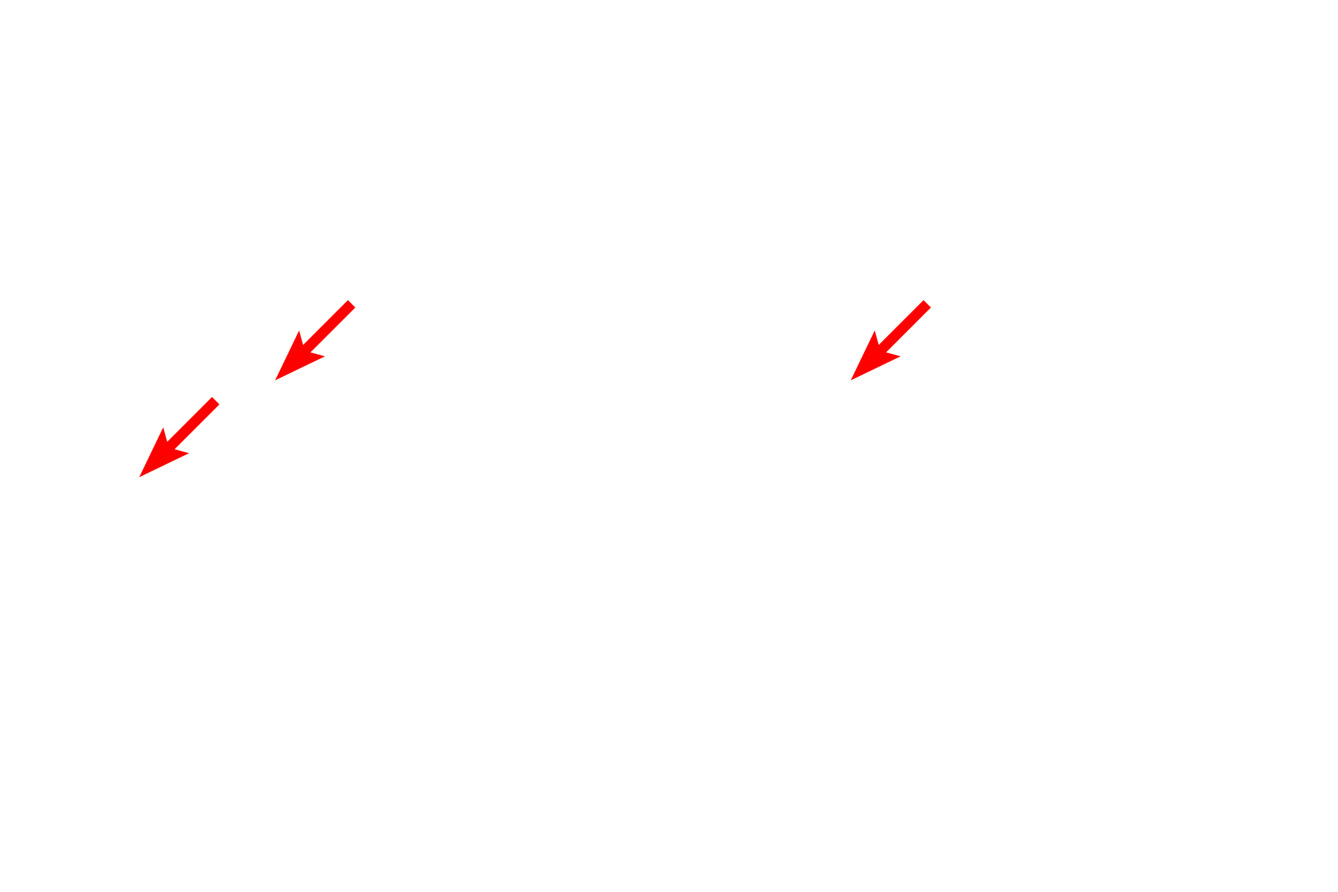 Microvilli > <p>Also visible are shorter microvilli, which contain a core of microfilaments and are non-motile.  The microfilaments are not resolved at this magnification.</p>
