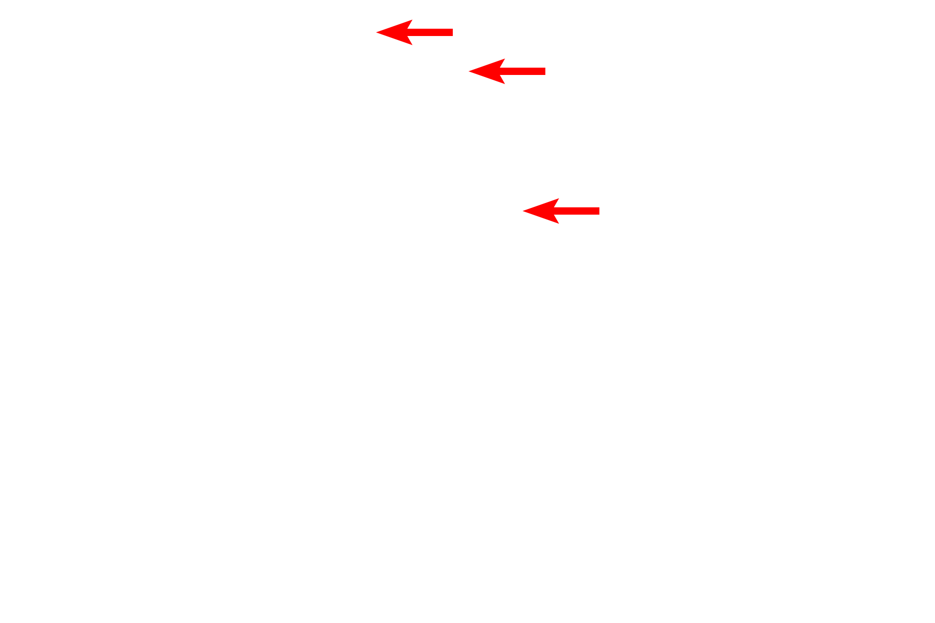  - Microtubules <p>This junctional complex is located between adjacent cells of a ciliated epithelium.  The apposition of the plasma membranes of the zonula occludens prevents leakage of luminal contents into the intercellular space.  Desmosome- and zonula adherens-associated filaments account for the cytoplasmic electron density adjacent to these structures.  50,000x</p>
