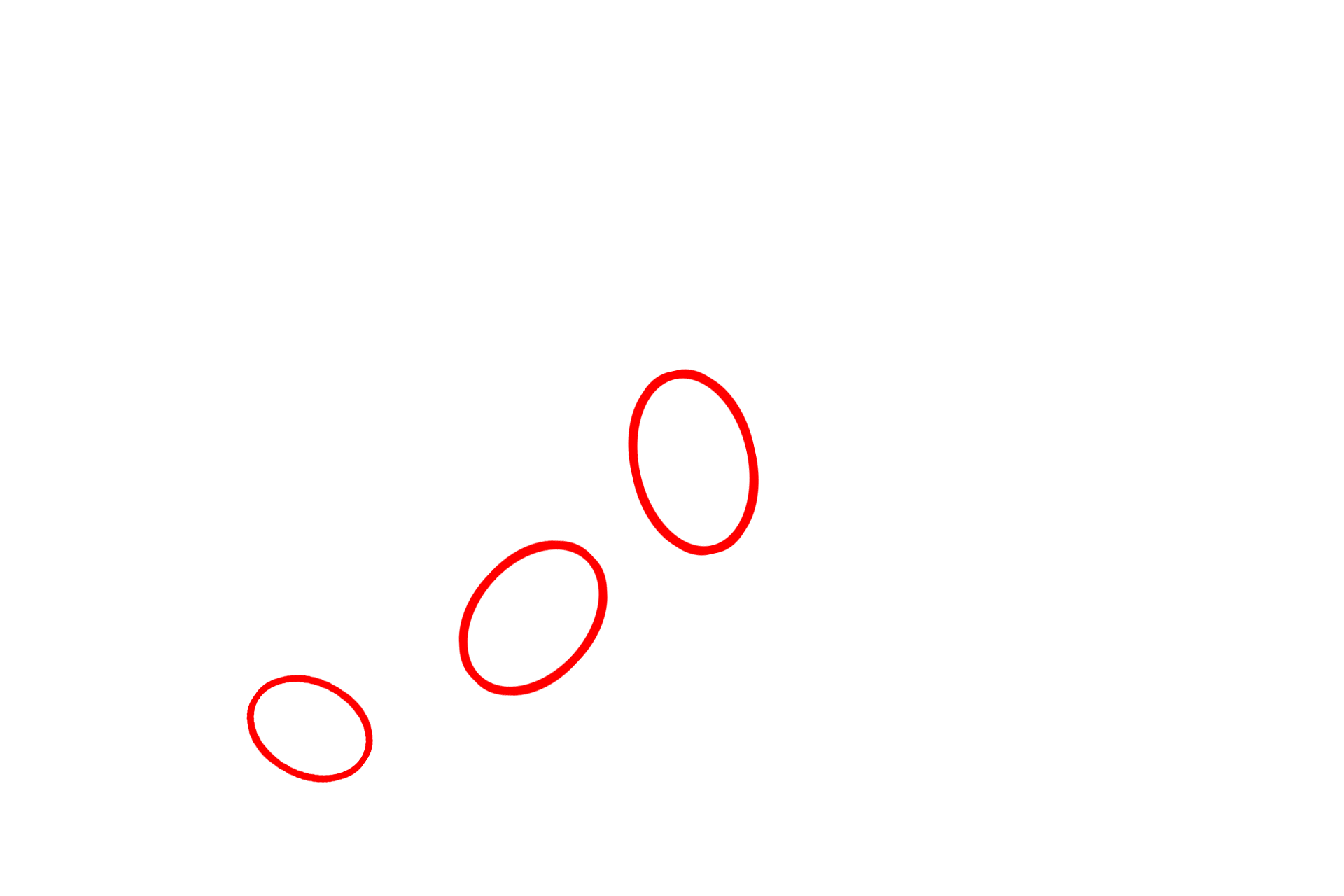 Desmosomes <p>A desmosome (macula adherens) is a symmetrical disc-shaped junction between cells which provides intercellular attachment.  This electron micrograph of the epidermis shows two adjacent cells with highly folded plasma membranes that are attached by numerous desmosomes.  The attachment plaque of the desmosome is anchored to the cytoskeleton by keratin intermediate filaments.  25,000x</p>
