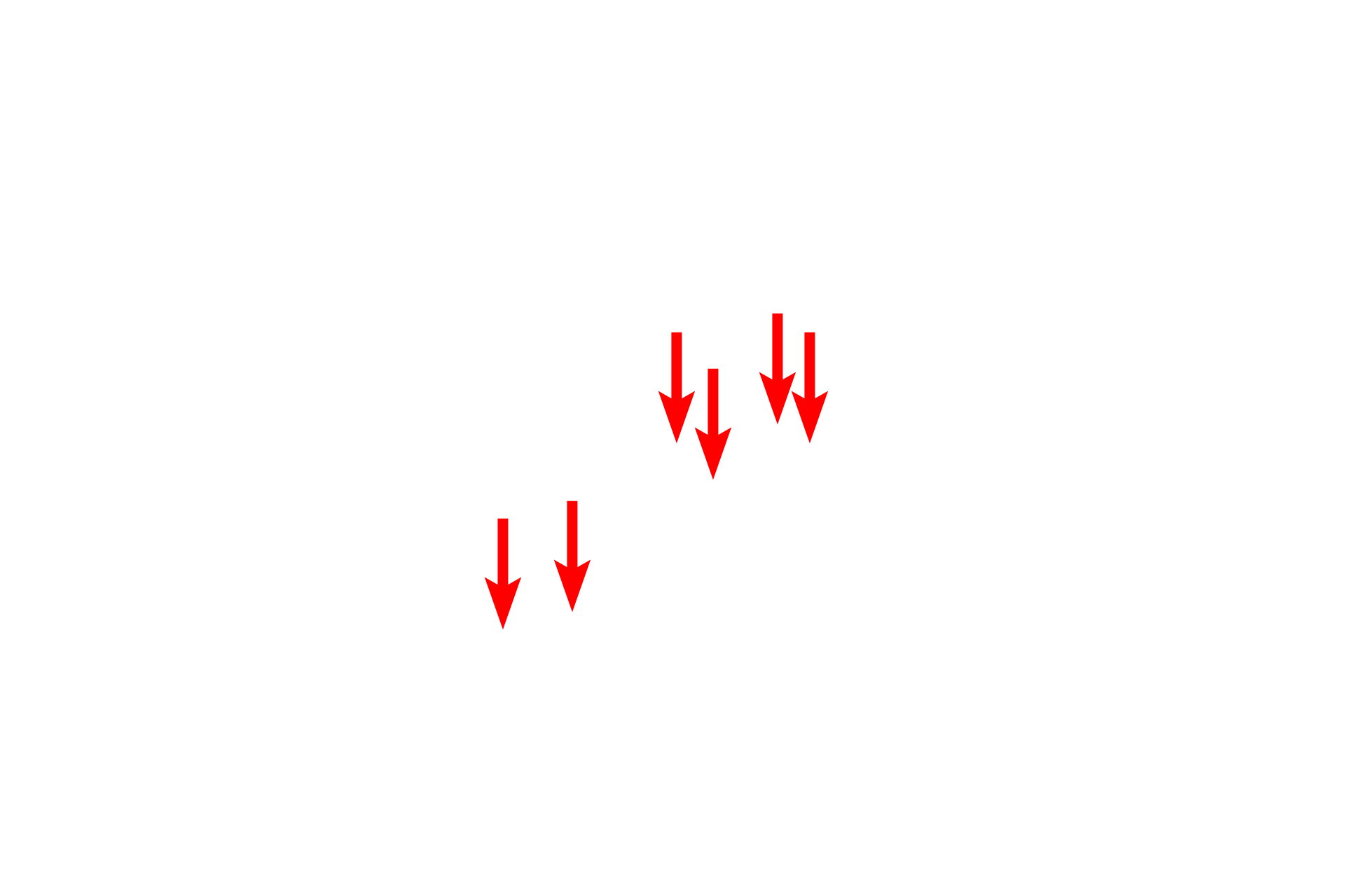  - Attachment plaques <p>A desmosome (macula adherens) is a symmetrical disc-shaped junction between cells which provides intercellular attachment.  This electron micrograph of the epidermis shows two adjacent cells with highly folded plasma membranes that are attached by numerous desmosomes.  The attachment plaque of the desmosome is anchored to the cytoskeleton by keratin intermediate filaments.  25,000x</p>
