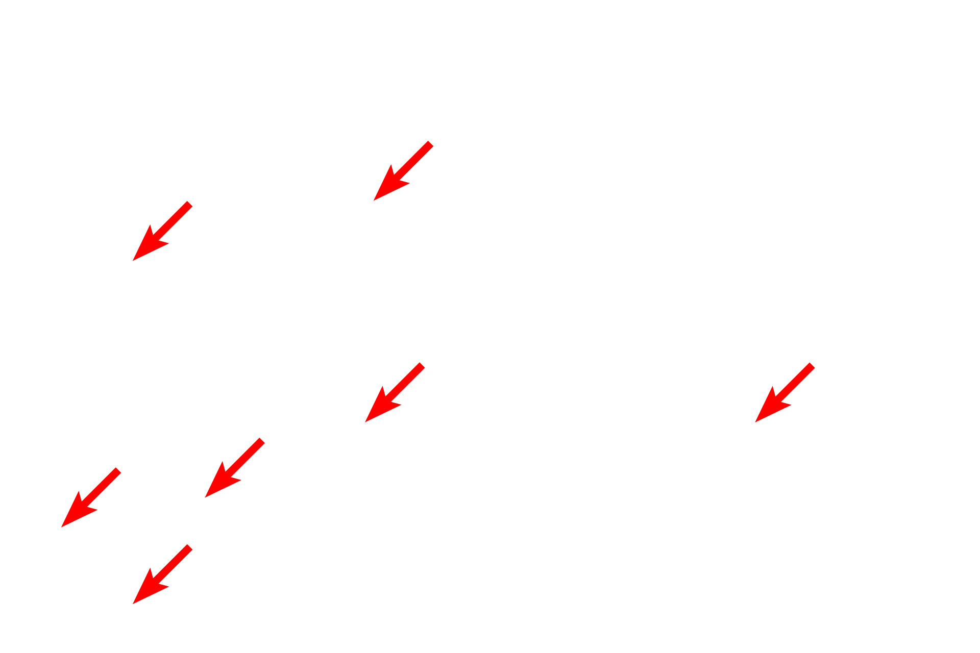  - Keratin filaments <p>A desmosome (macula adherens) is a symmetrical disc-shaped junction between cells which provides intercellular attachment.  This electron micrograph of the epidermis shows two adjacent cells with highly folded plasma membranes that are attached by numerous desmosomes.  The attachment plaque of the desmosome is anchored to the cytoskeleton by keratin intermediate filaments.  25,000x</p>
