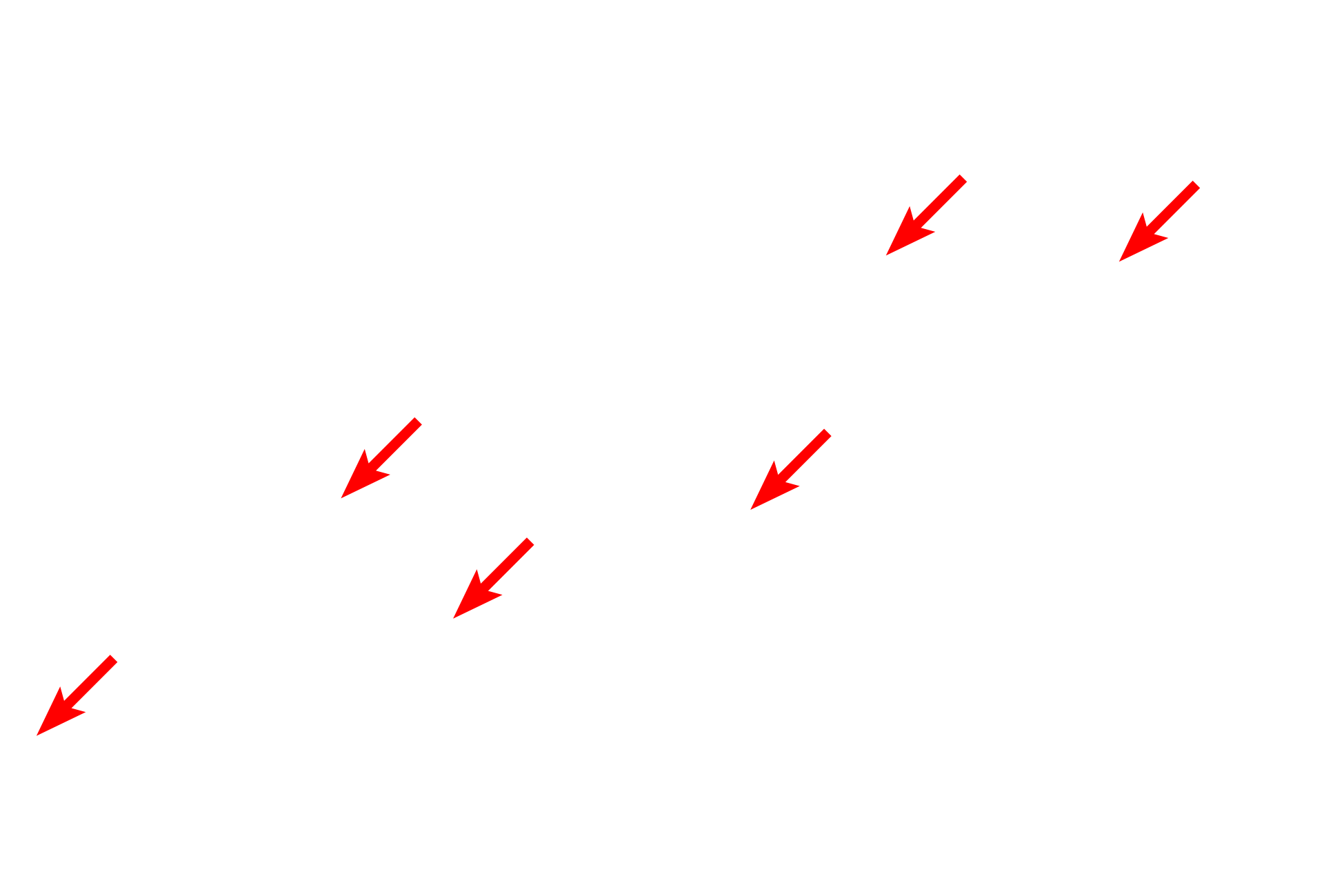 Plasma membranes <p>A desmosome (macula adherens) is a symmetrical disc-shaped junction between cells which provides intercellular attachment.  This electron micrograph of the epidermis shows two adjacent cells with highly folded plasma membranes that are attached by numerous desmosomes.  The attachment plaque of the desmosome is anchored to the cytoskeleton by keratin intermediate filaments.  25,000x</p>
