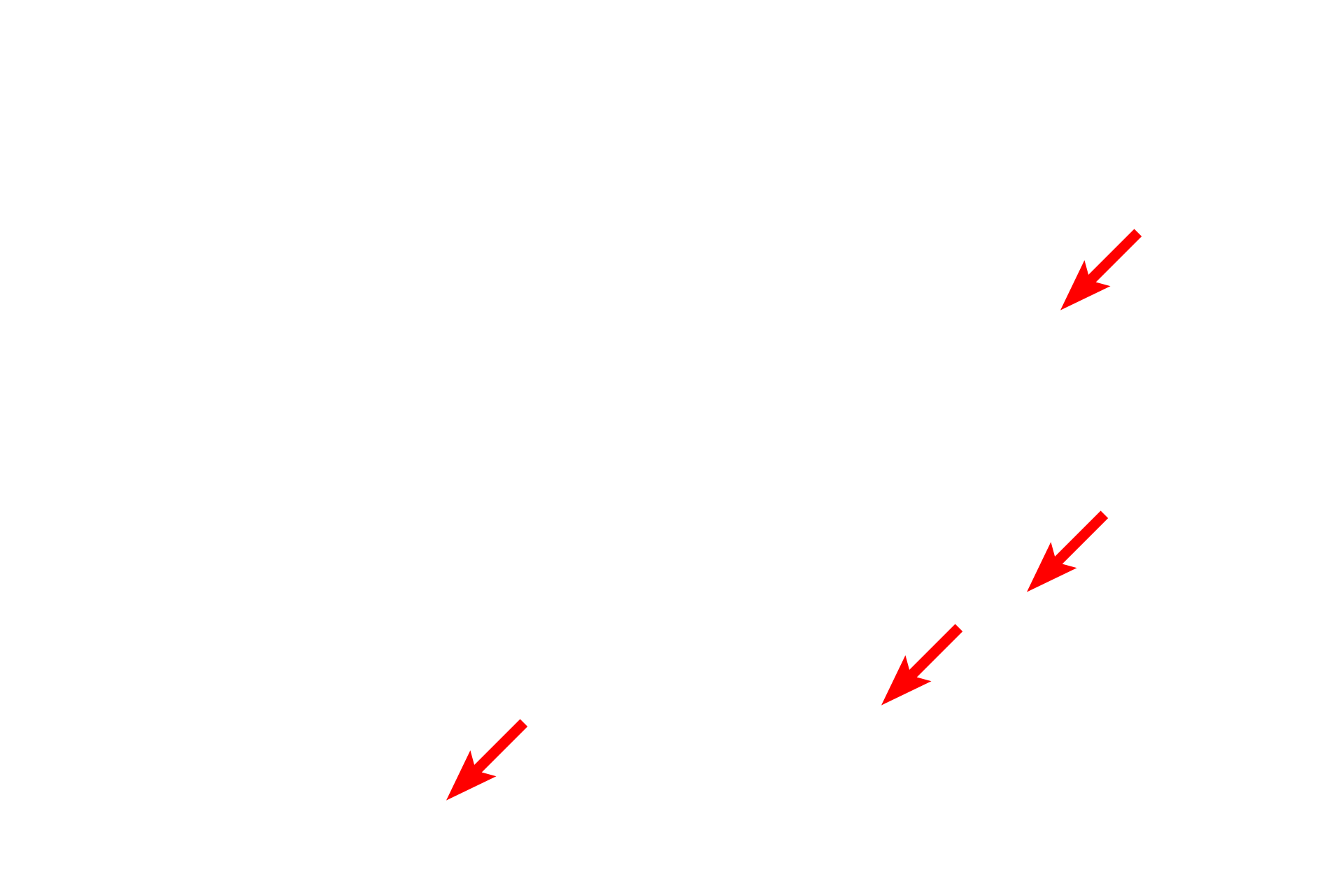  - Attachment plaques <p>Hemidesmosomes are prominent in the basal layer of the epidermis.  Structurally, they consist of one-half of a desmosome and serve to anchor an epithelium to its underlying basal lamina.  The associated keratin intermediate filaments insert into the attachment plaques.  Transmembrane proteins extend from the plaque into the basal lamina to provide attachment.  30,000x</p>
