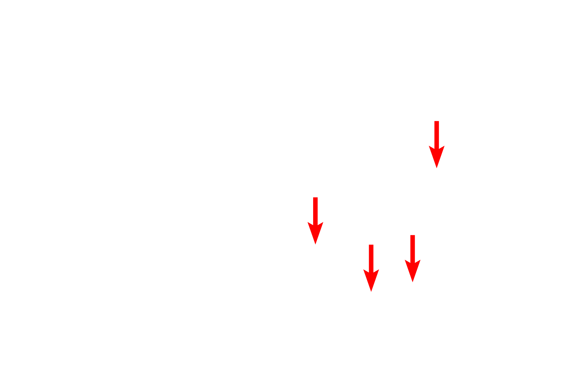  - Keratin filaments <p>Hemidesmosomes are prominent in the basal layer of the epidermis.  Structurally, they consist of one-half of a desmosome and serve to anchor an epithelium to its underlying basal lamina.  The associated keratin intermediate filaments insert into the attachment plaques.  Transmembrane proteins extend from the plaque into the basal lamina to provide attachment.  30,000x</p>
