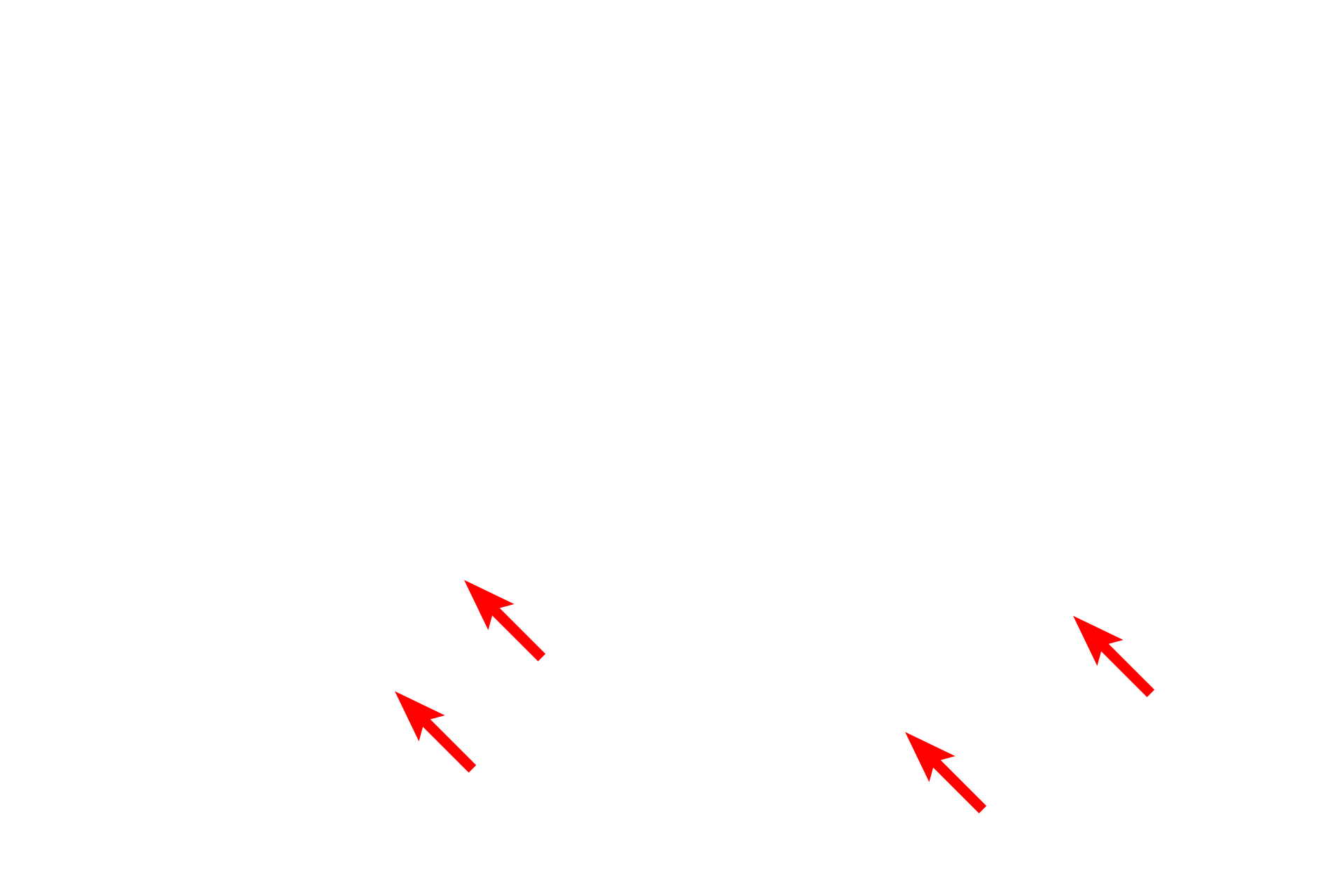 Lamina densa of basal lamina <p>Hemidesmosomes are prominent in the basal layer of the epidermis.  Structurally, they consist of one-half of a desmosome and serve to anchor an epithelium to its underlying basal lamina.  The associated keratin intermediate filaments insert into the attachment plaques.  Transmembrane proteins extend from the plaque into the basal lamina to provide attachment.  30,000x</p>
