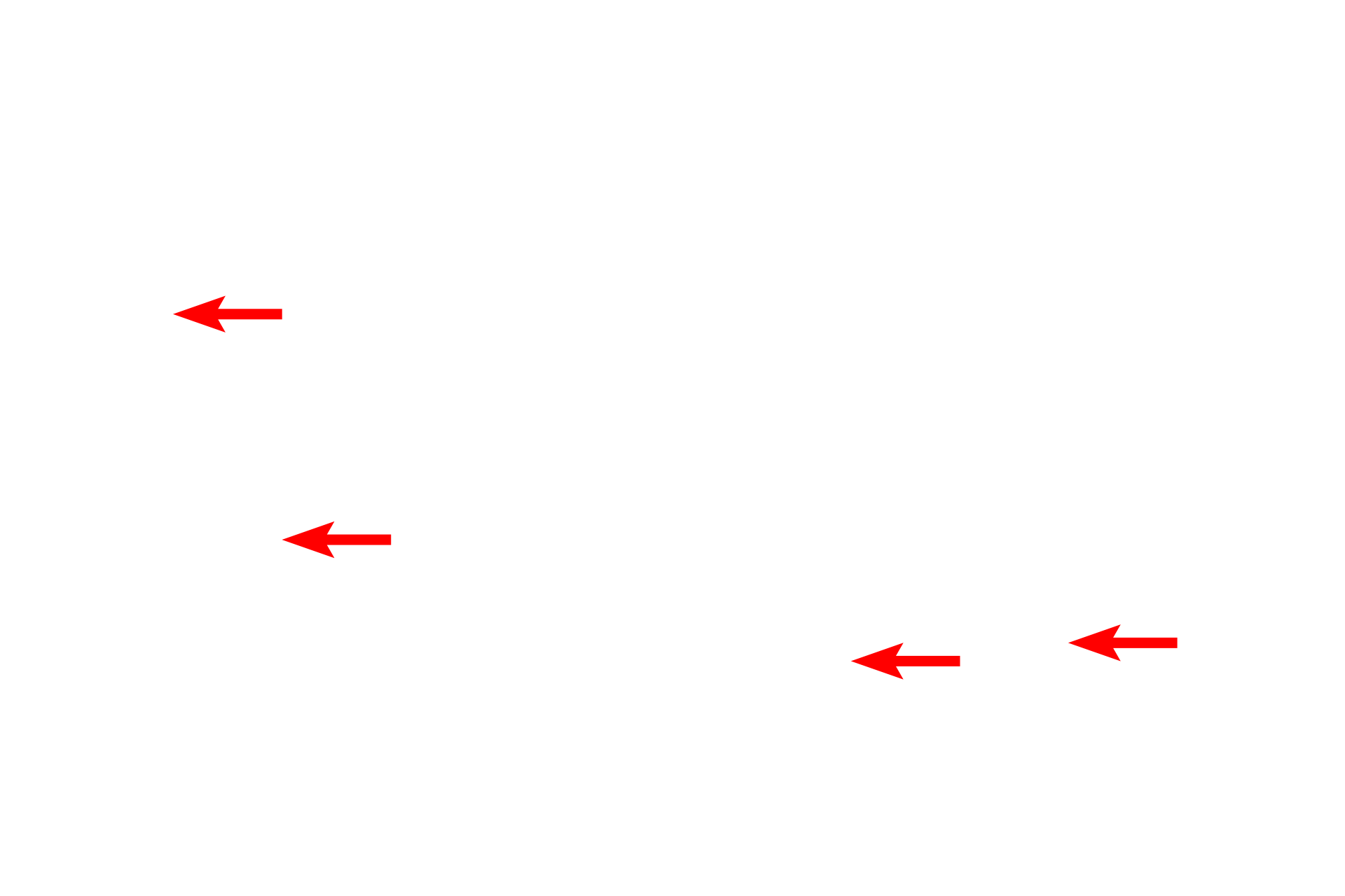 Anchoring fibrils <p>This electron micrograph of human skin shows the details of the basement membrane of an epithelium that is exposed to significant physical force. Numerous hemidesmosomes, which anchor the basal surface of the epithelial cells to the basal lamina, are present. Associated keratin filaments insert into the attachment plaques of the hemidesmosomes. Also visible are prominent anchoring fibrils that secure the epithelium to the underlying connective tissue. 45,000x</p>
