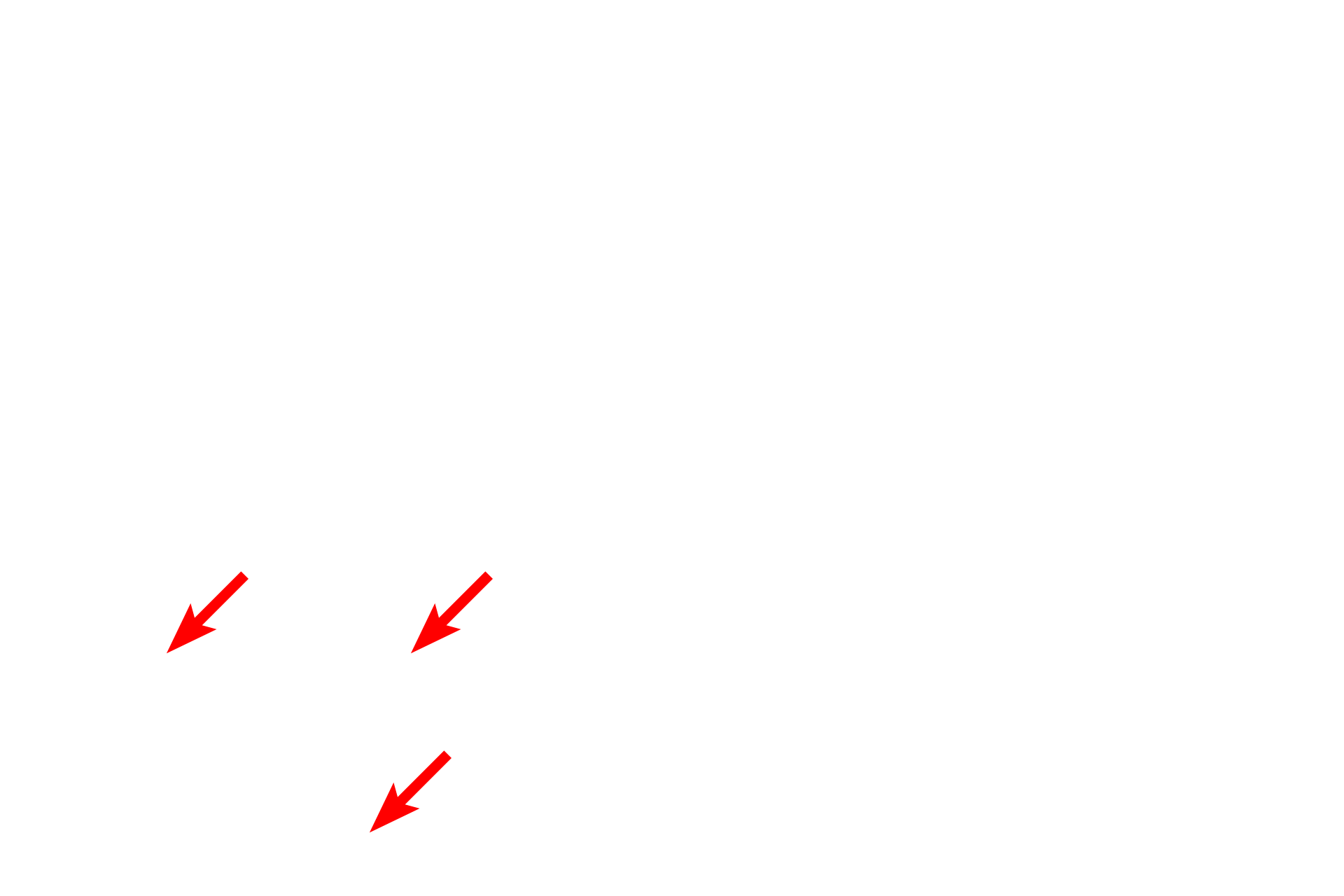 Mitochondria <p>The junctional complex consists of a zonula occludens (apical-most), zonula adherens and a desmosome which collectively serve to attach adjacent cells and seal the luminal space from the intercellular space.</p>
