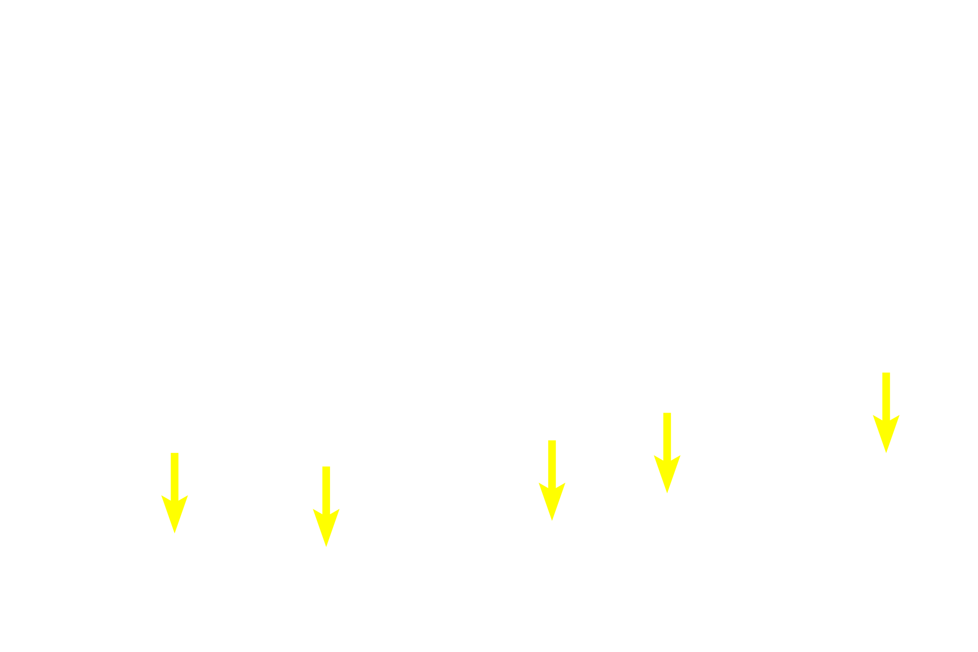 Short basal cells <p>A tubule from the male reproductive tract is lined by a pseudostratified epithelium with stereocilia.  Stereocilia are long (greater than one micron), non-motile extensions of the apical plasma membrane that have the same internal structure as microvilli.  Like microvilli, they contain a core of microfilaments.  As seen here, tufts of stereocilia often appear flame-shaped.  Epididymis  1000x</p>
