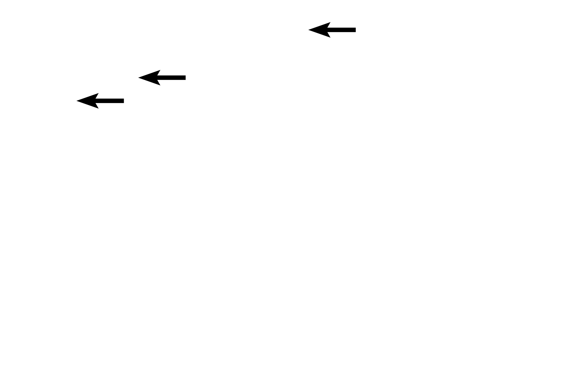 Stereocilia <p>Stereocilia are modified microvilli which facilitate absorption of luminal contents.  Also visible are terminal bars, the light microscopic term for junctional complexes that are better resolved with the electron microscope.  1500x</p>
