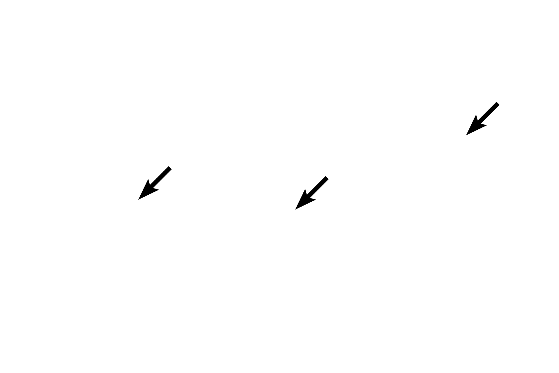  - Columnar cells <p>Pseudostratified epithelium has tall columnar and short basal cells, all of which contact the basement membrane.  The layered appearance of the nuclei make this epithelium appear stratified, hence the term, pseudostratified.  Because this is truly a simple epithelium, it can possess surface specializations, such as stereocilia.  Epididymis  400x</p>
