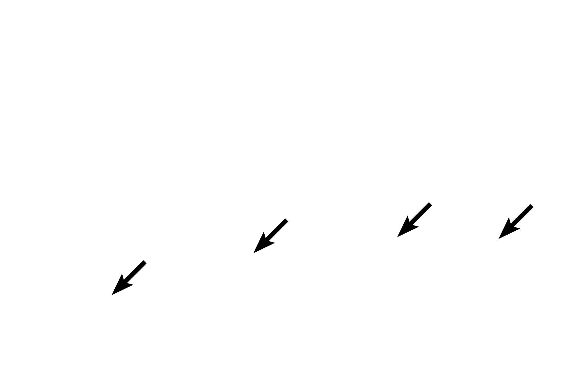  - Columnar cell nuclei <p>Pseudostratified epithelium has tall columnar and short basal cells, all of which contact the basement membrane.  The layered appearance of the nuclei make this epithelium appear stratified, hence the term, pseudostratified.  Because this is truly a simple epithelium, it can possess surface specializations, such as stereocilia.  Epididymis  400x</p>
