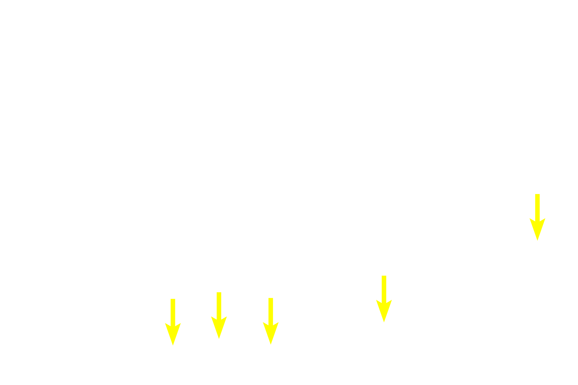  - Basal cell nuclei <p>Pseudostratified epithelium has tall columnar and short basal cells, all of which contact the basement membrane.  The layered appearance of the nuclei make this epithelium appear stratified, hence the term, pseudostratified.  Because this is truly a simple epithelium, it can possess surface specializations, such as stereocilia.  Epididymis  400x</p>

