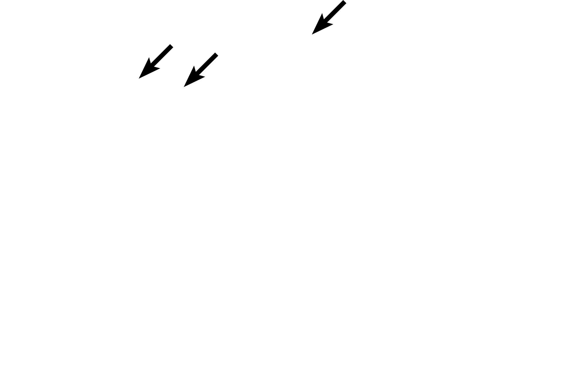  - Stereocilia <p>Pseudostratified epithelium has tall columnar and short basal cells, all of which contact the basement membrane.  The layered appearance of the nuclei make this epithelium appear stratified, hence the term, pseudostratified.  Because this is truly a simple epithelium, it can possess surface specializations, such as stereocilia.  Epididymis  400x</p>
