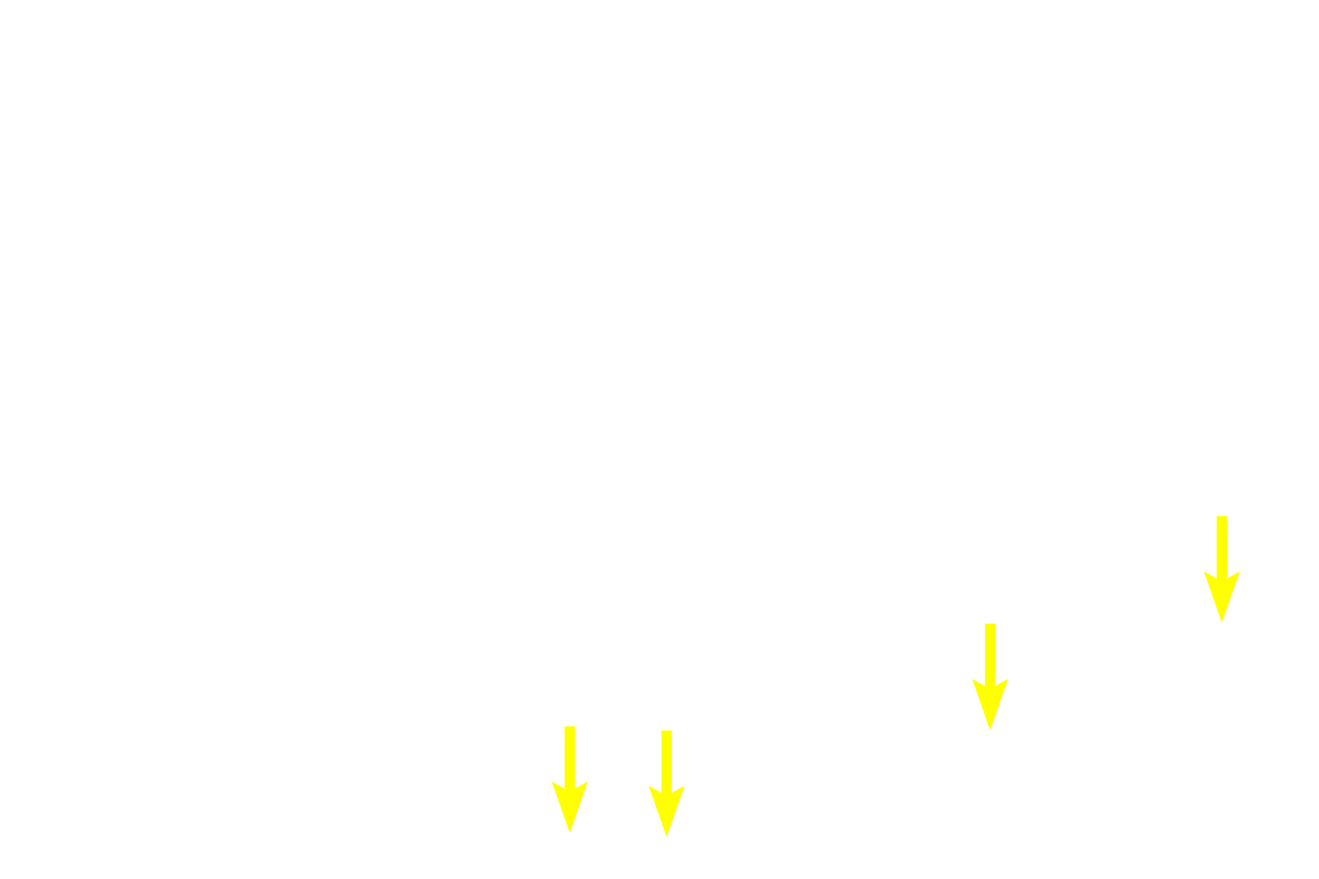 Basement membrane <p>Pseudostratified epithelium has tall columnar and short basal cells, all of which contact the basement membrane.  The layered appearance of the nuclei make this epithelium appear stratified, hence the term, pseudostratified.  Because this is truly a simple epithelium, it can possess surface specializations, such as stereocilia.  Epididymis  400x</p>
