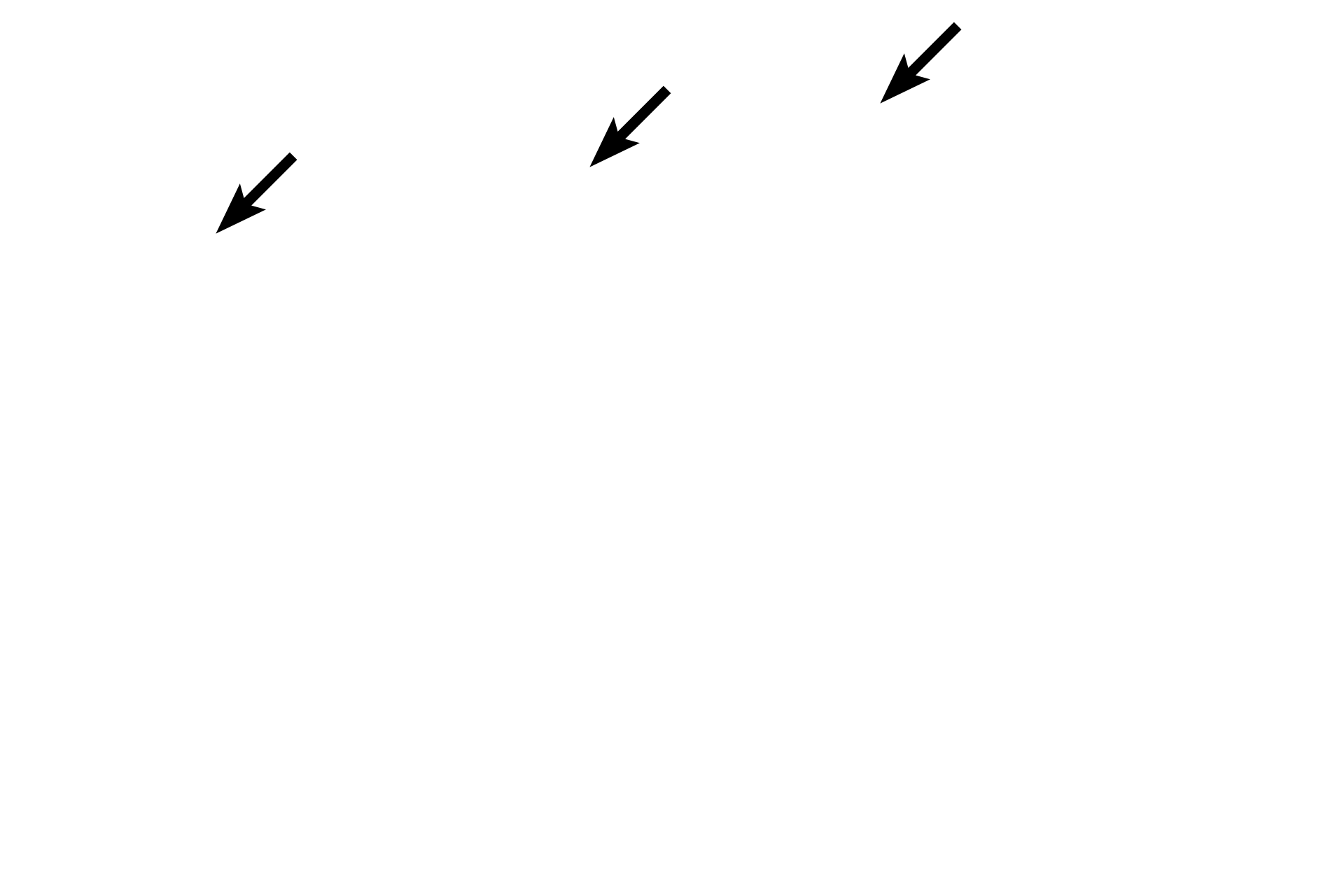  - Cilia <p>Although pseudostratified epithelium appears stratified, all of its cells rest on the basement membrane.  The epithelium pictured here is ciliated and possesses unicellular glands that secrete mucus, called goblet cells. Both the cilia and unicellular glands indicate that this is a simple epithelium.  Trachea  1000x</p>
