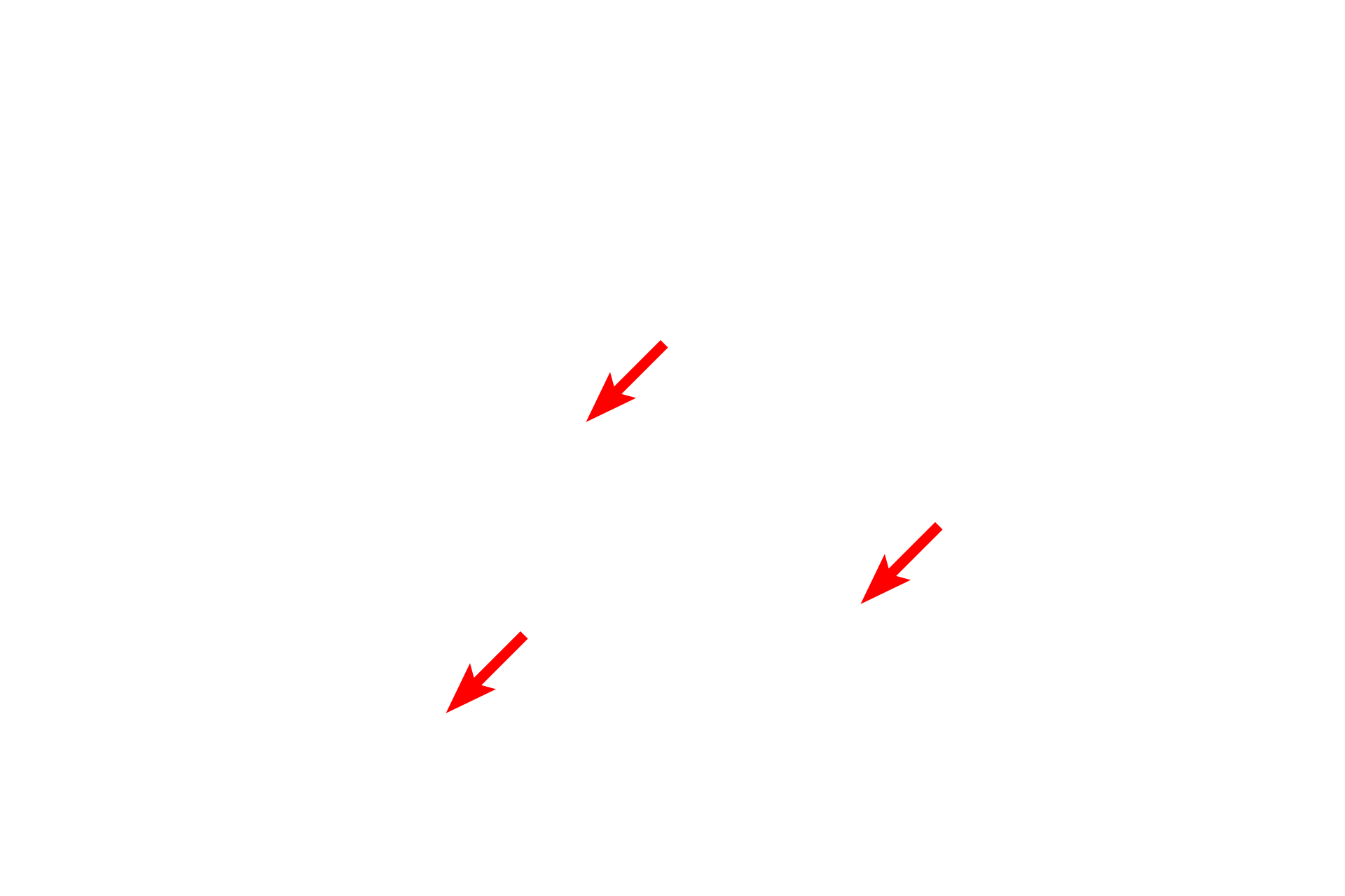  - Basal cells <p>The lining epithelium of the monkey trachea demonstrates a pseudostratified epithelium with cilia and gland cells (goblet cells).  In a pseudostratified epithelium, all cells rest on the basement membrane, though not all reach the free surface.  This variation in height, and thus position of the nuclei, gives the impression of a stratified epithelium.  1000x</p>
