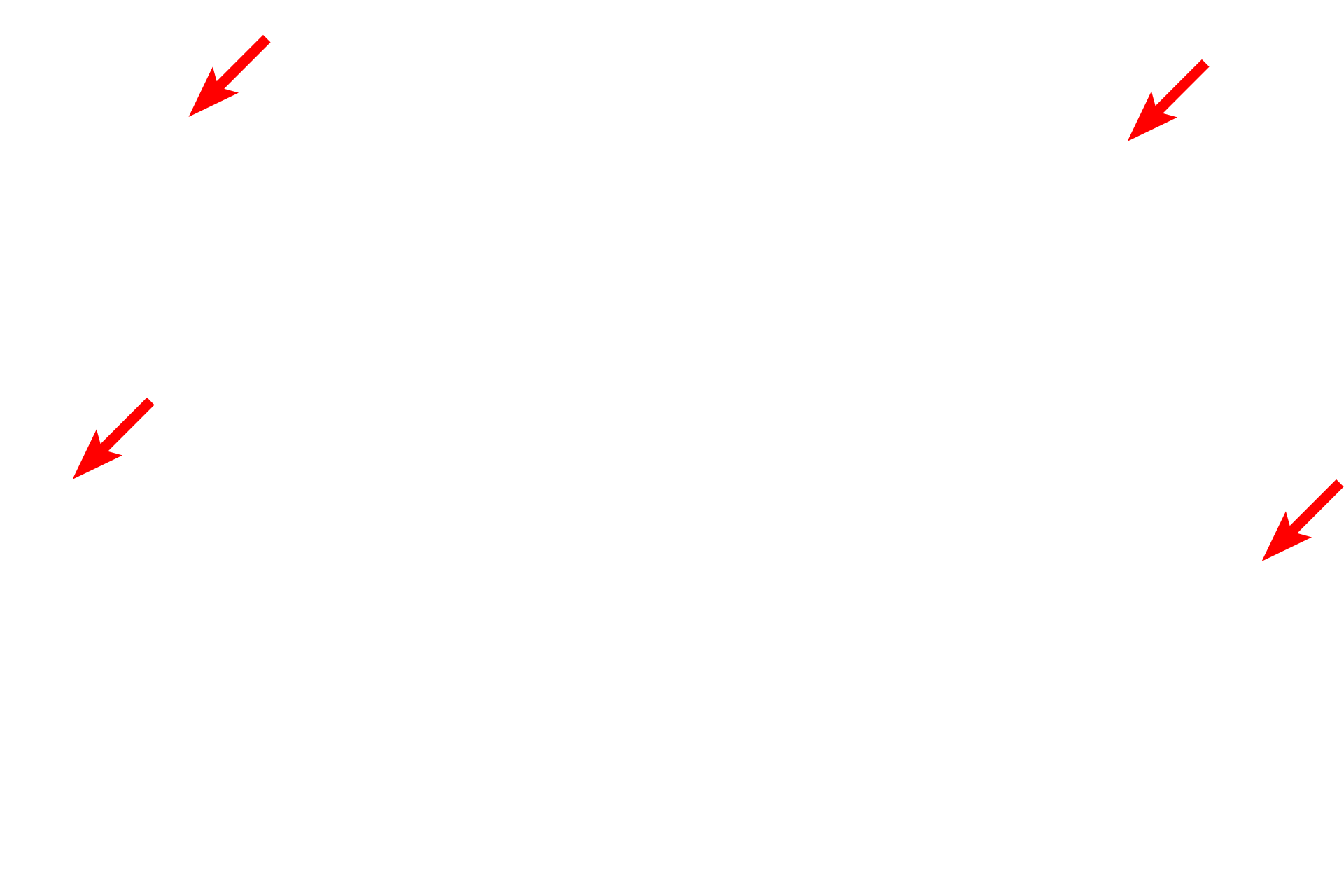  - Cilia <p>The lining epithelium of the monkey trachea demonstrates a pseudostratified epithelium with cilia and gland cells (goblet cells).  In a pseudostratified epithelium, all cells rest on the basement membrane, though not all reach the free surface.  This variation in height, and thus position of the nuclei, gives the impression of a stratified epithelium.  1000x</p>
