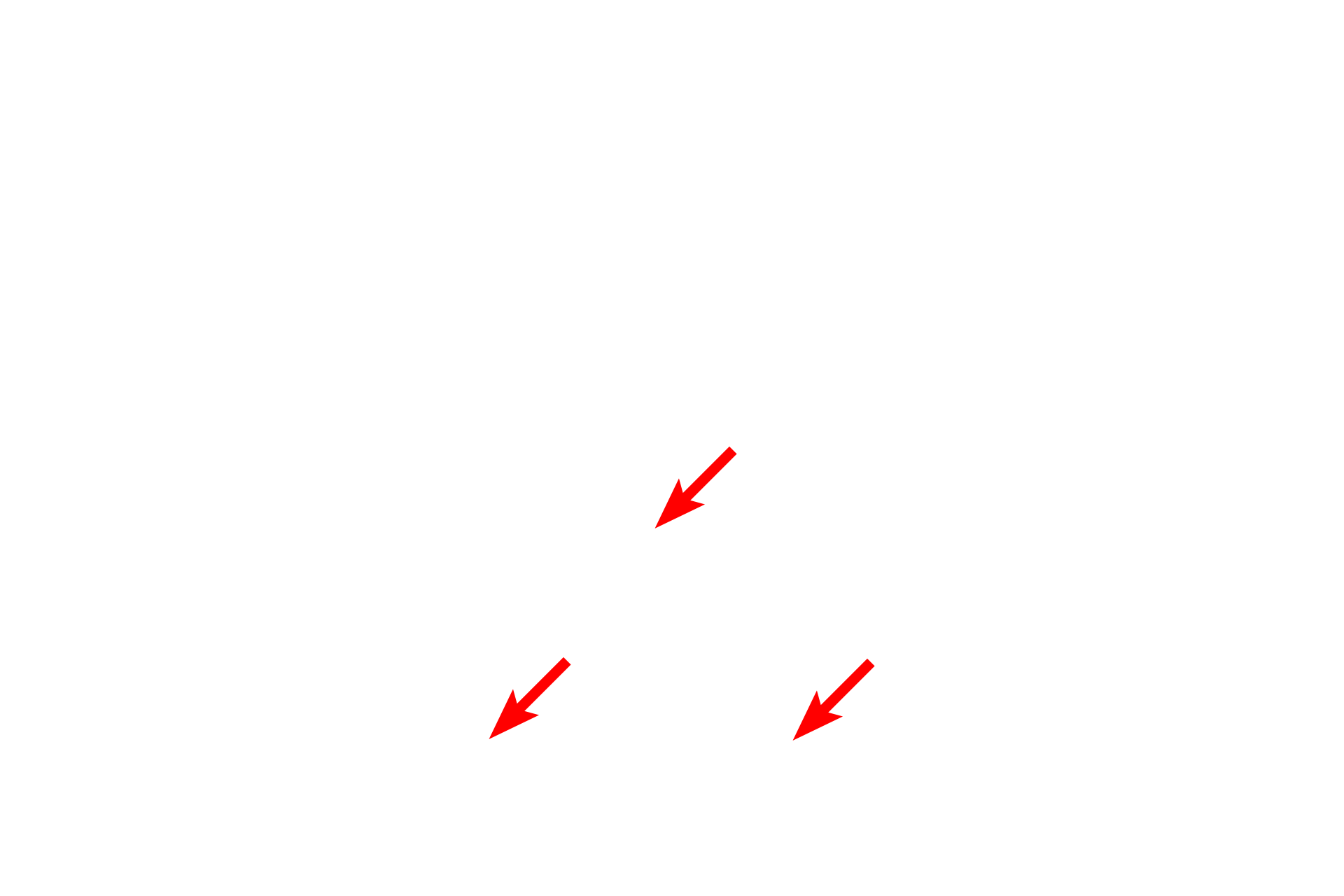 Basement membrane <p>The lining epithelium of the monkey trachea demonstrates a pseudostratified epithelium with cilia and gland cells (goblet cells).  In a pseudostratified epithelium, all cells rest on the basement membrane, though not all reach the free surface.  This variation in height, and thus position of the nuclei, gives the impression of a stratified epithelium.  1000x</p>
