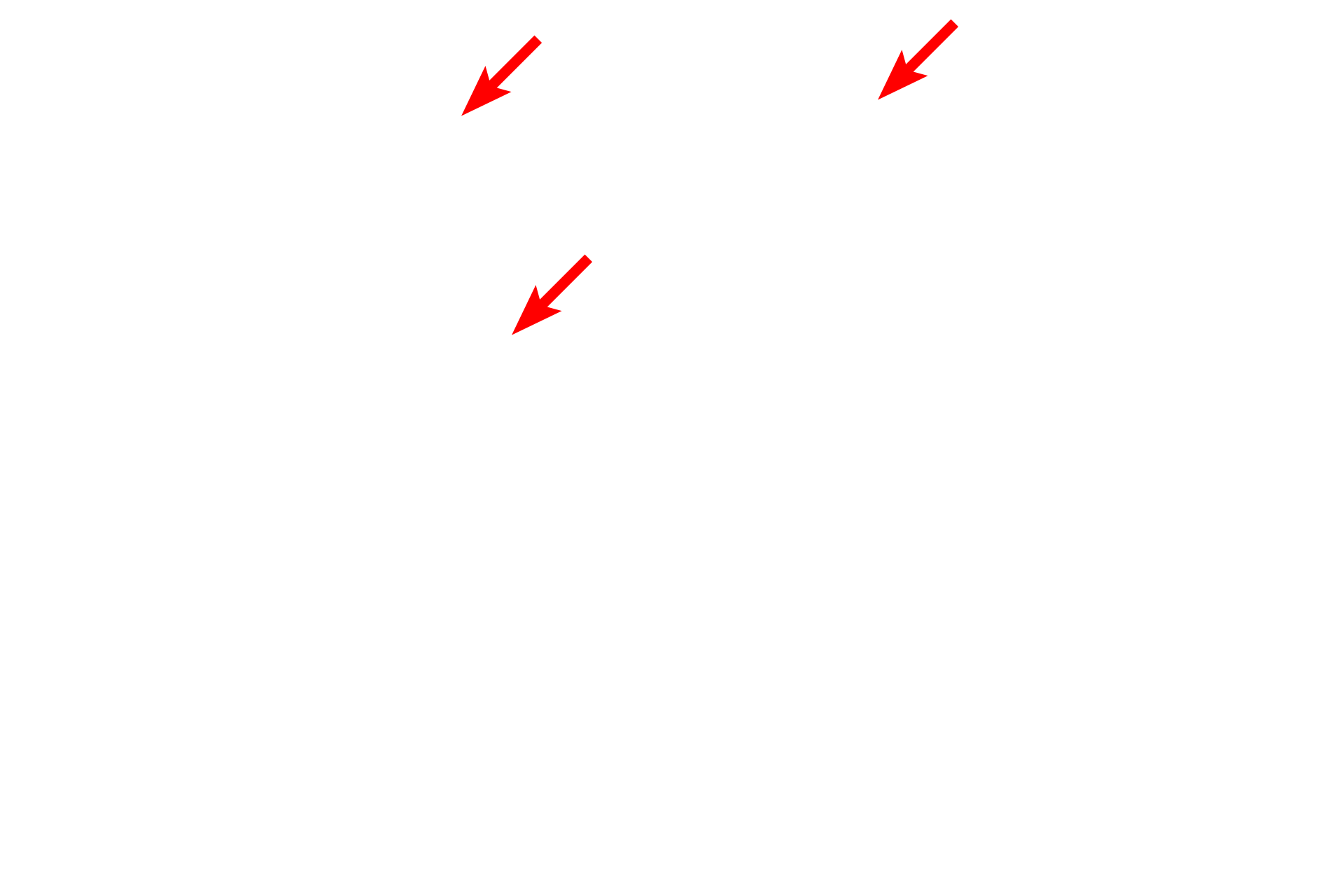  - Cilia <p>The lining epithelium of the monkey trachea demonstrates a pseudostratified epithelium with cilia and gland cells, called goblet cells.  Goblet cells release mucin proteins which, when hydrated, form mucus.  The mucus traps inhaled particles and the entire mucous sheet is moved upwards by the beating action of the cilia.  1200x</p>

