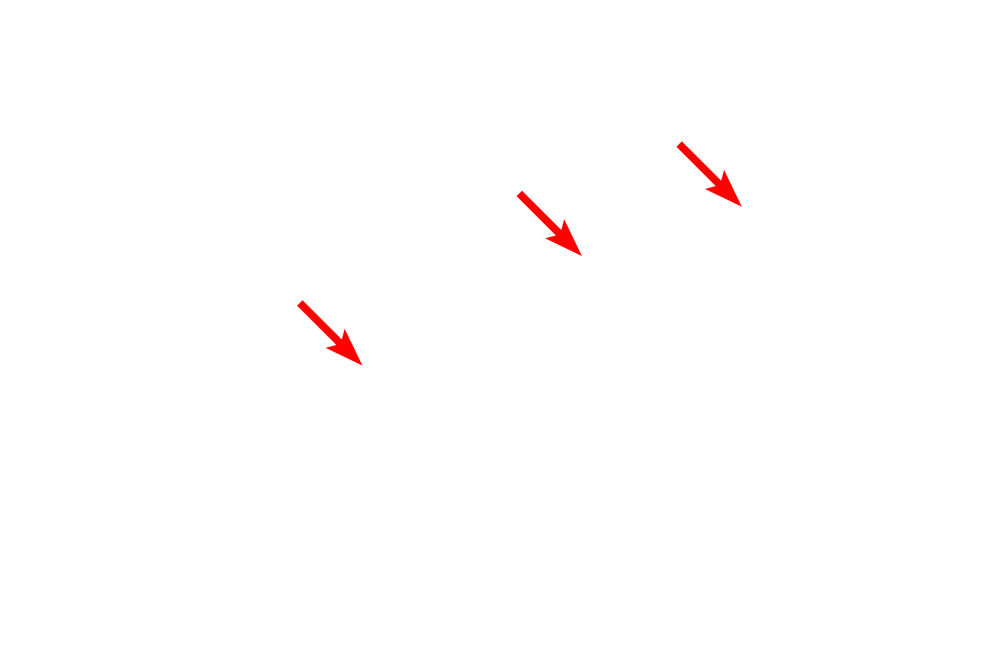Nucleus <p>This electron micrograph shows a squamous cell that forms part of the lining (serosa) of an internal body cavity.  The cell has very little cytoplasm and a highly flattened nucleus, characteristic of a squamous cell.  At its thinnest point, this cell is only 0.5 micron thick.  Serosa  15,000x</p>
