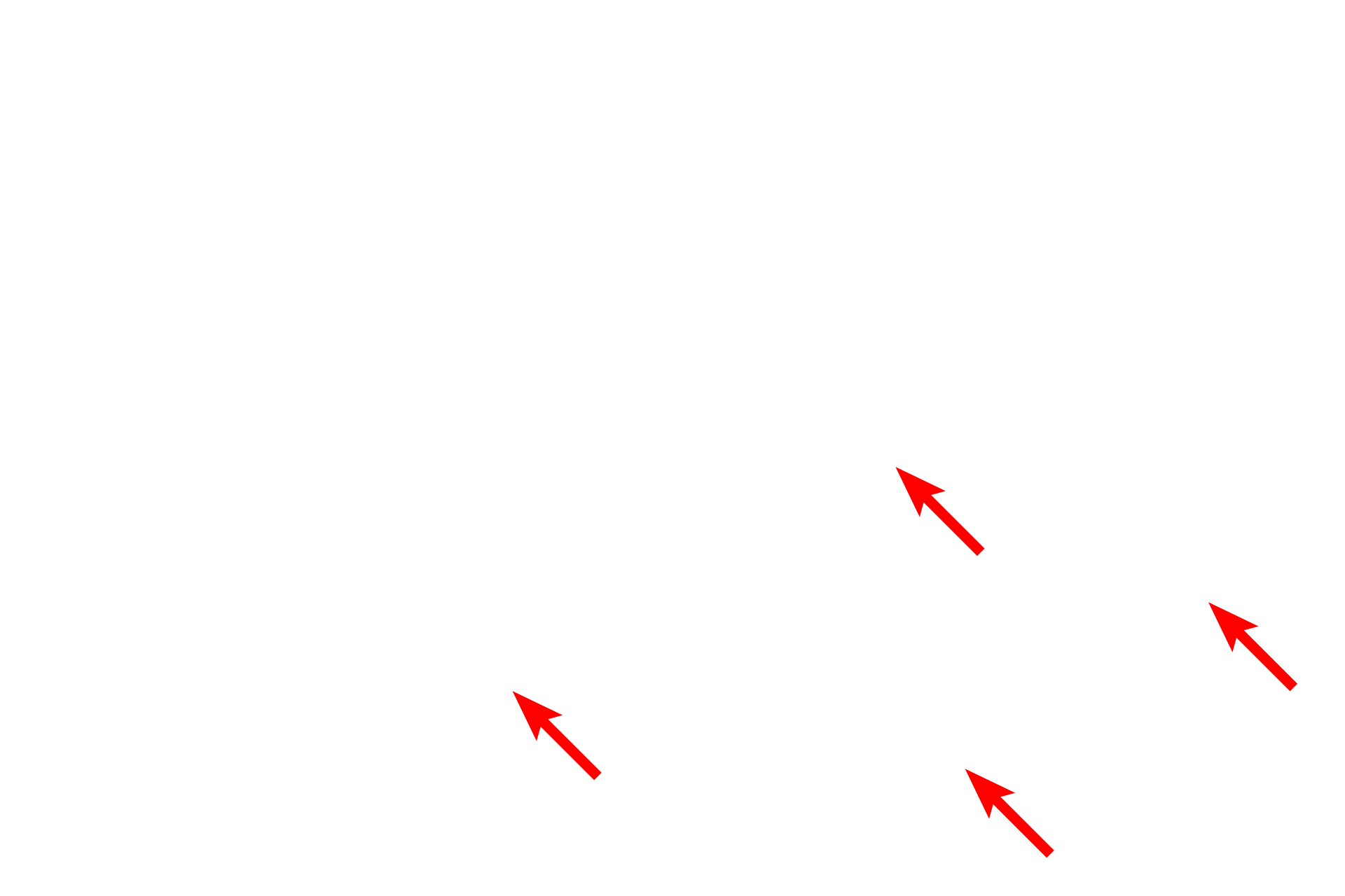 Collagen fibrils <p>This electron micrograph shows a squamous cell that forms part of the lining (serosa) of an internal body cavity.  The cell has very little cytoplasm and a highly flattened nucleus, characteristic of a squamous cell.  At its thinnest point, this cell is only 0.5 micron thick.  Serosa  15,000x</p>
