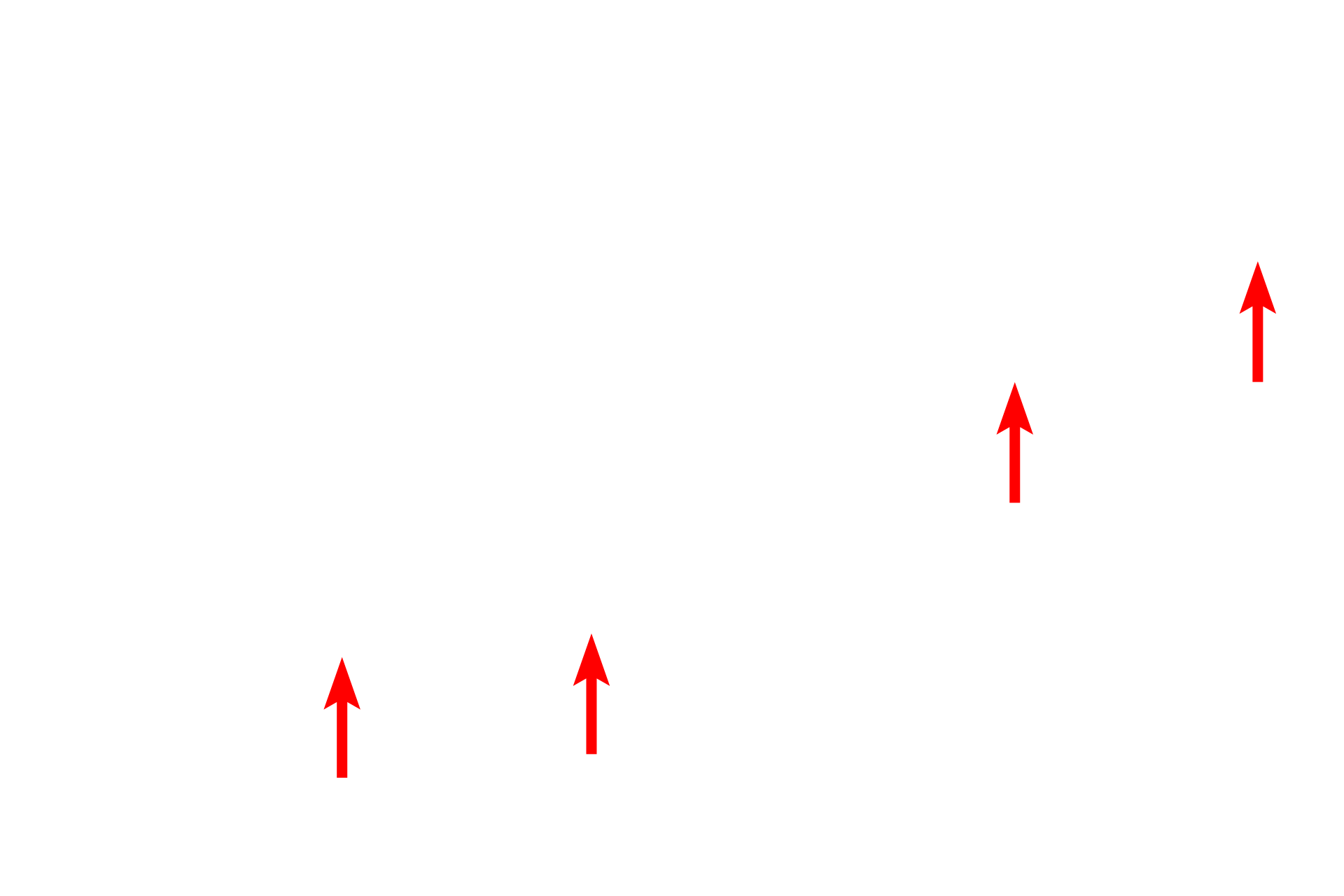 Basal lamina <p>This electron micrograph shows a squamous cell that forms part of the lining (serosa) of an internal body cavity.  The cell has very little cytoplasm and a highly flattened nucleus, characteristic of a squamous cell.  At its thinnest point, this cell is only 0.5 micron thick.  Serosa  15,000x</p>
