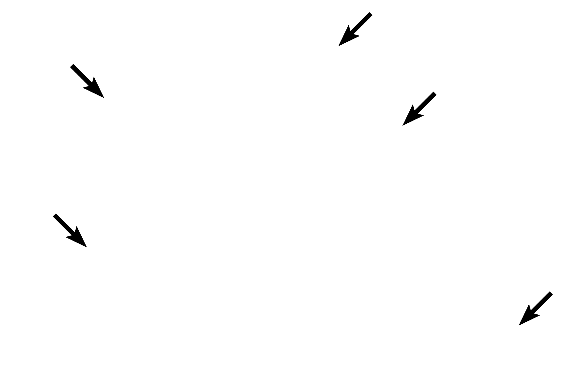  - Microvilli (brush border) <p>Simple columnar epithelium lines the intestine, as seen here in the duodenum.  Also visible is a brush border, composed of closely packed microvilli, which are commonly present on simple columnar epithelia.  Interspersed between the cells are unicellular glands called goblet cells which secrete mucus.  The mucus is released onto the epithelial surface.  Small intestine  300x</p>
