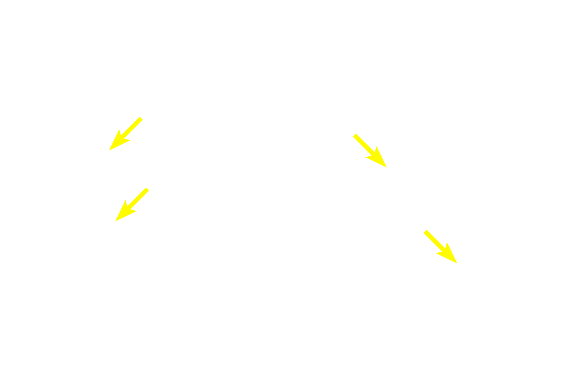  - Unicellular glands (goblet cells) <p>Simple columnar epithelium lines the intestine, as seen here in the duodenum.  Also visible is a brush border, composed of closely packed microvilli, which are commonly present on simple columnar epithelia.  Interspersed between the cells are unicellular glands called goblet cells which secrete mucus.  The mucus is released onto the epithelial surface.  Small intestine  300x</p>
