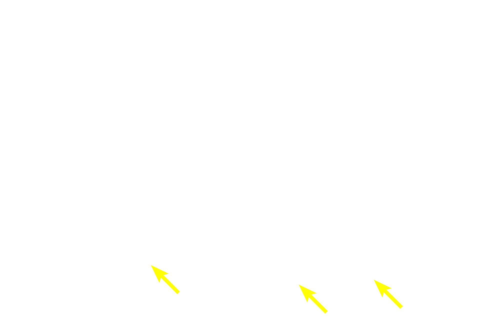 Basement membrane <p>Stratified epithelia have multiple layers and are further classified by the shape of the cells at the surface.  In stratified squamous epithelia, cells flatten as they are pushed from basal to surface layers.  Surface cells are living, with visible nuclei.  A layer of keratin does not form and the epithelium remains moist.  Esophagus  400x</p>

