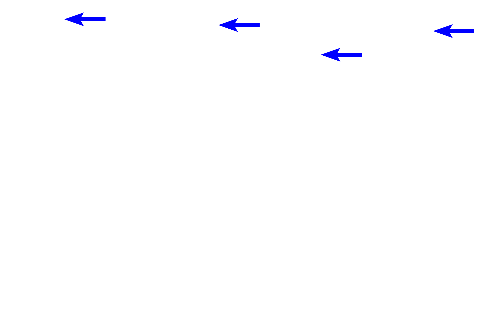 - Squamous cells <p>This epithelium covers internal body surfaces which are exposed to some degree of physical trauma or abrasion.  This epithelium has a basal layer of cuboidal cells that are mitotically active.  Above them are several layers of polygonal cells that become progressively more flattened, until they become squamous at the luminal surface.  Vagina  400x</p>
