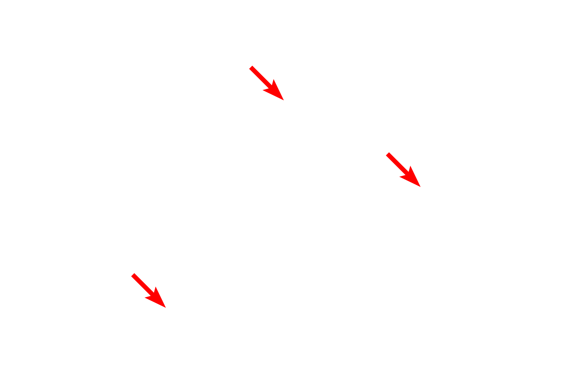 Squamous cells <p>This electron micrograph of the lining of the esophagus shows the structure of the superficial-most cells.  In this epithelium, the surface cells are living and possess a variety of organelles, as well as a prominent nucleus.  The cells in this image are in the process of being sloughed from the surface of the epithelium.  6000x</p>
