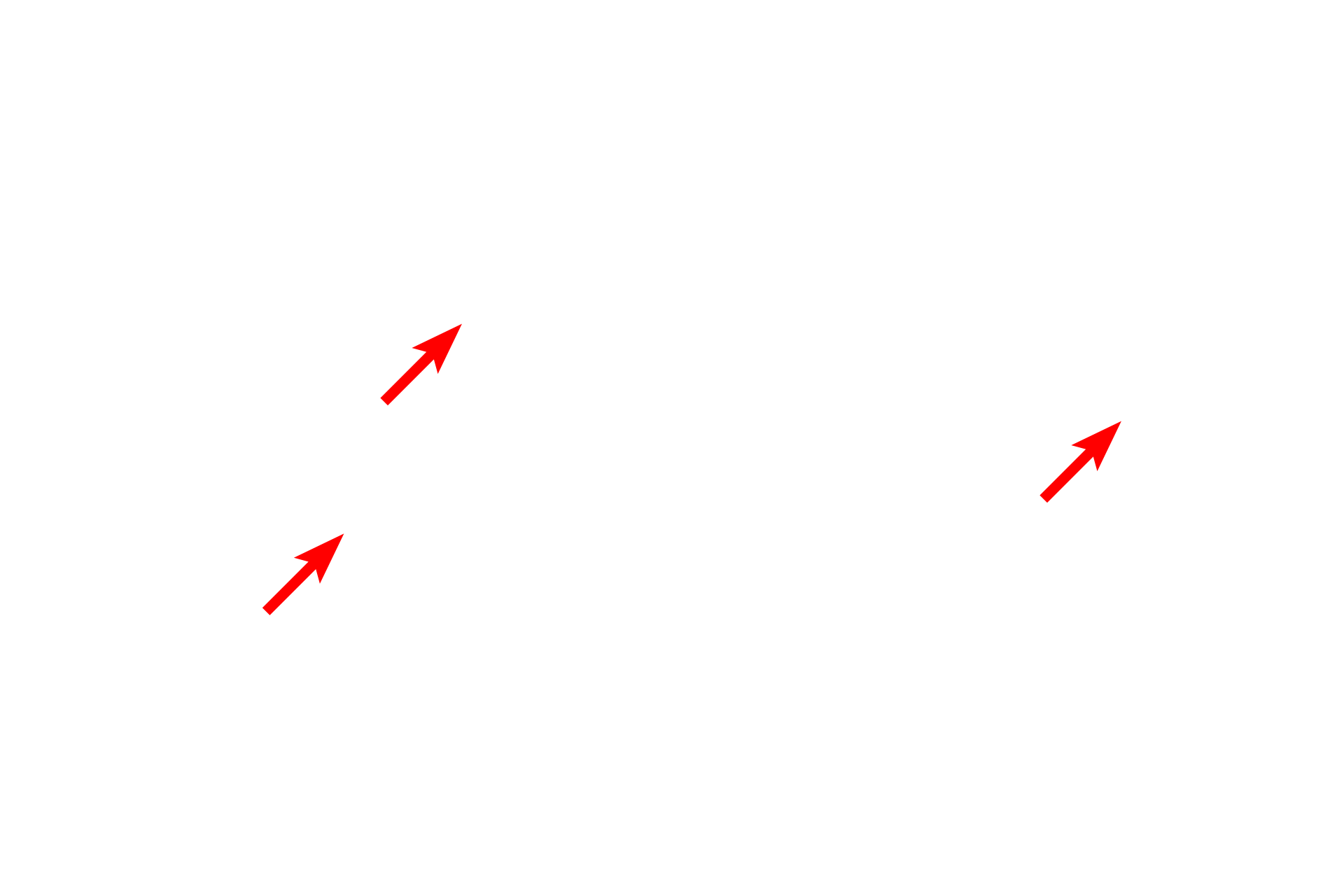  - Organelles <p>This electron micrograph of the lining of the esophagus shows the structure of the superficial-most cells.  In this epithelium, the surface cells are living and possess a variety of organelles, as well as a prominent nucleus.  The cells in this image are in the process of being sloughed from the surface of the epithelium.  6000x</p>
