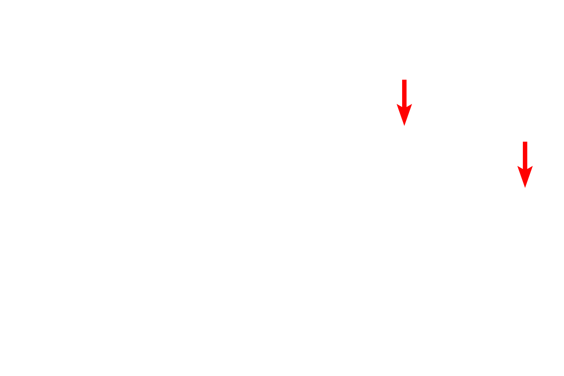 Skin surface <p>The superficial-most cells of the epithelium of human skin are shown in an electron micrograph.  This epithelium is stratified squamous, keratinized, and thus the superficial-most cells (red arrows) are non-living, lack organelles and consist primarily of a thickened plasma membrane enclosing keratin.  Cells which have been sloughed are indicated by the blue arrows.</p>
