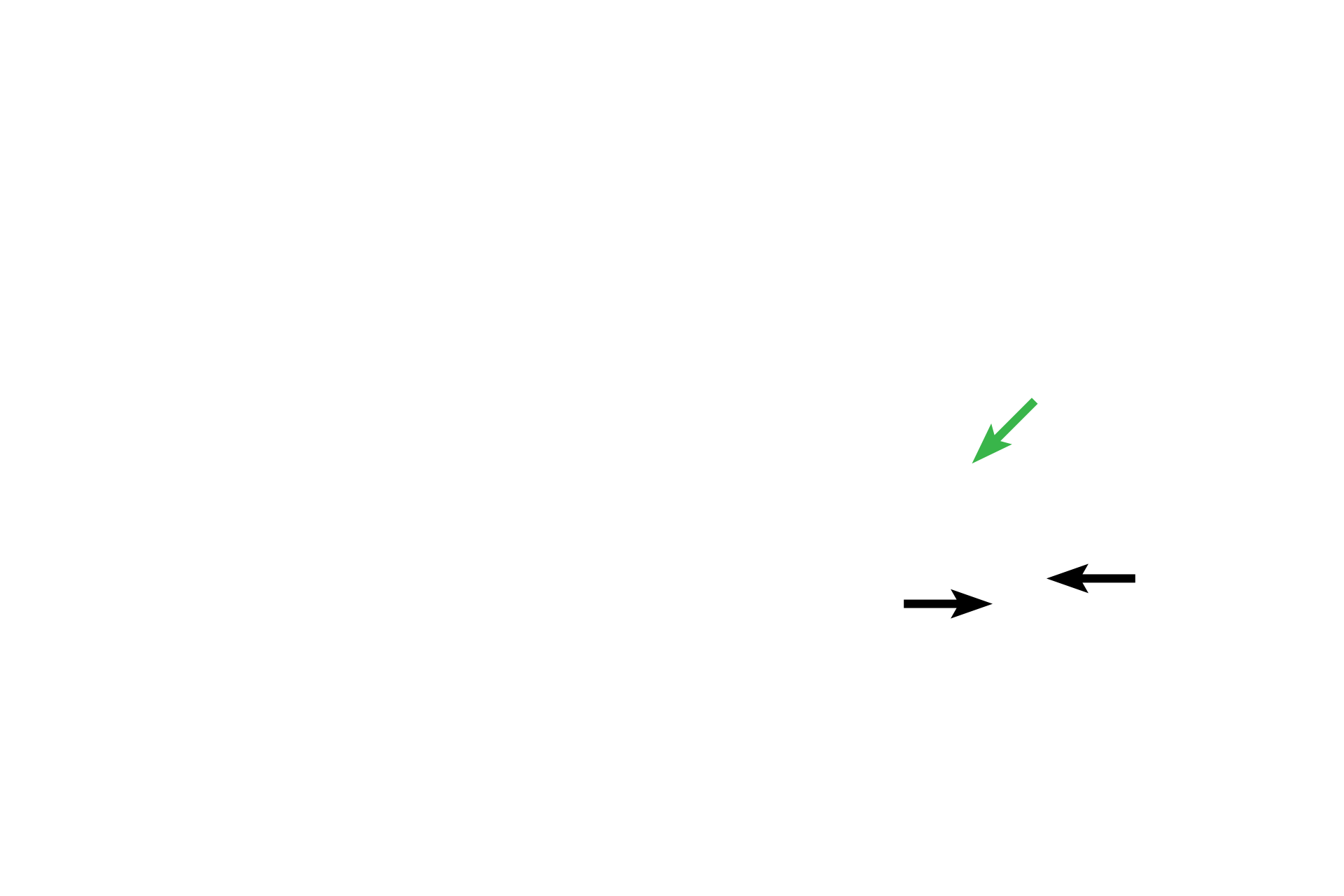 Conducting system > <p>The conducting system, modified cardiac muscle fibers, coordinates and regulates heartbeat.  This system consists of a sinoatrial node (pacemaker), fibers spreading through the atria, AV node located in lower part of the interatrial septum, AV bundle (green arrow) in the interventricular septum, and two bundle branches (black arrows) continuing as Purkinje fibers to innervate ventricular myocardium.</p>
