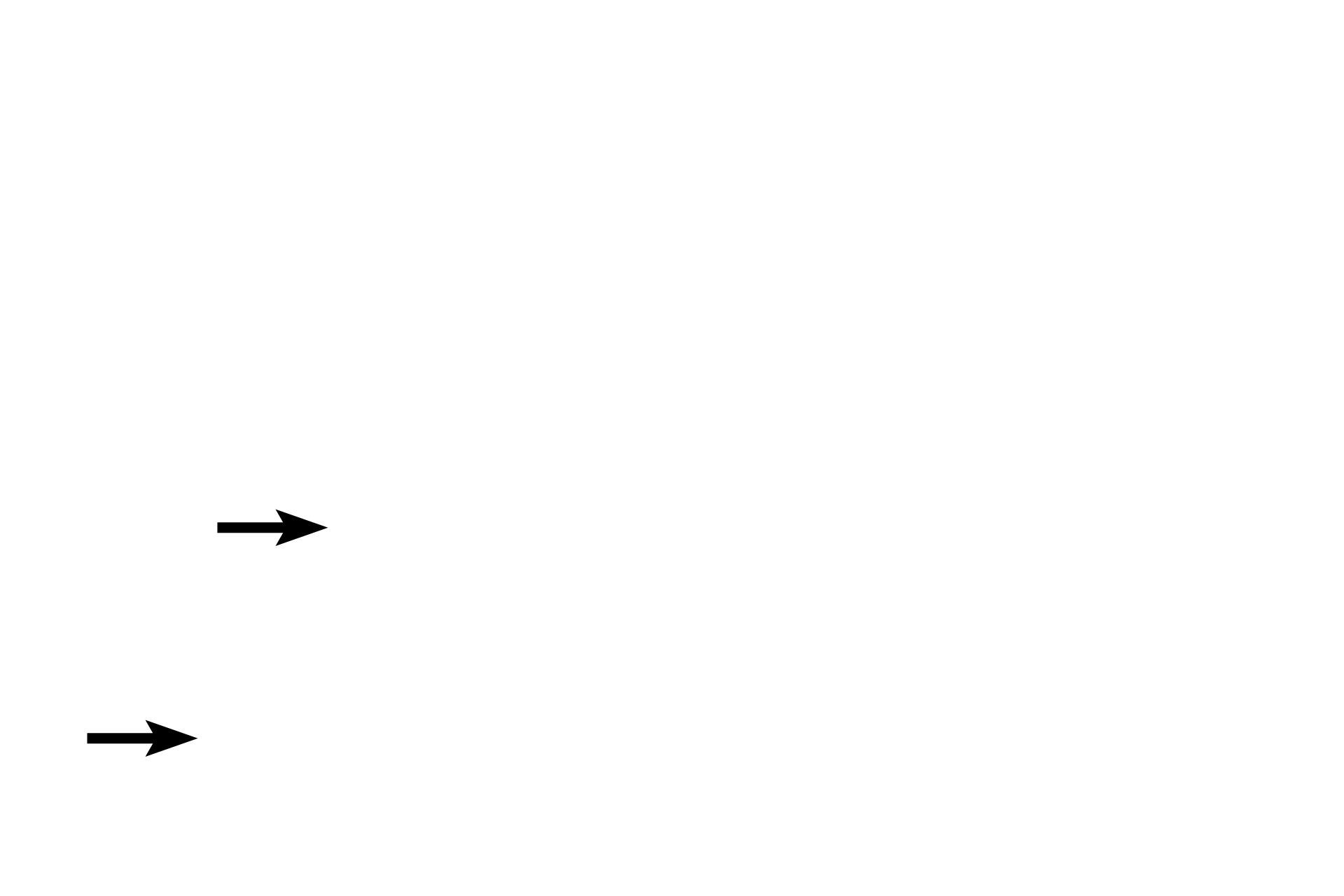 Right atrioventricular valve <p>An annulus fibrosus is a ring-shaped, local thickening of connecting tissue that encircles the base of each cardiac valve.  The annulus is a component of the cardiac skeleton and is continuous with the connective tissue core of each valve leaflet, providing support for the valve as well anchorage for the insertion of cardiac muscle fibers.  100x</p>
