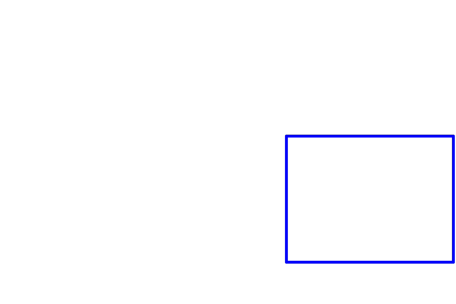 Aortic valve leaflet <p>A higher magnification of the previous slide shows the dense core of connective tissue of the valve and the region of the annulus fibrosus.  Endothelium covers the free surface of each valve.  400x</p>
