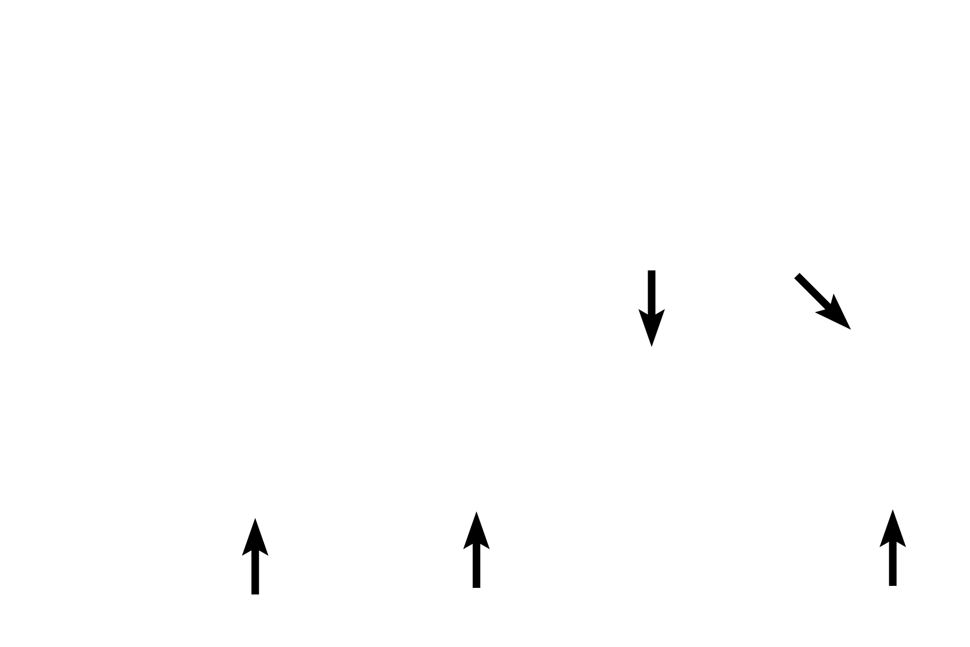 Endothelium <p>A higher magnification of the previous slide shows the dense core of connective tissue of the valve and the region of the annulus fibrosus.  Endothelium covers the free surface of each valve.  400x</p>
