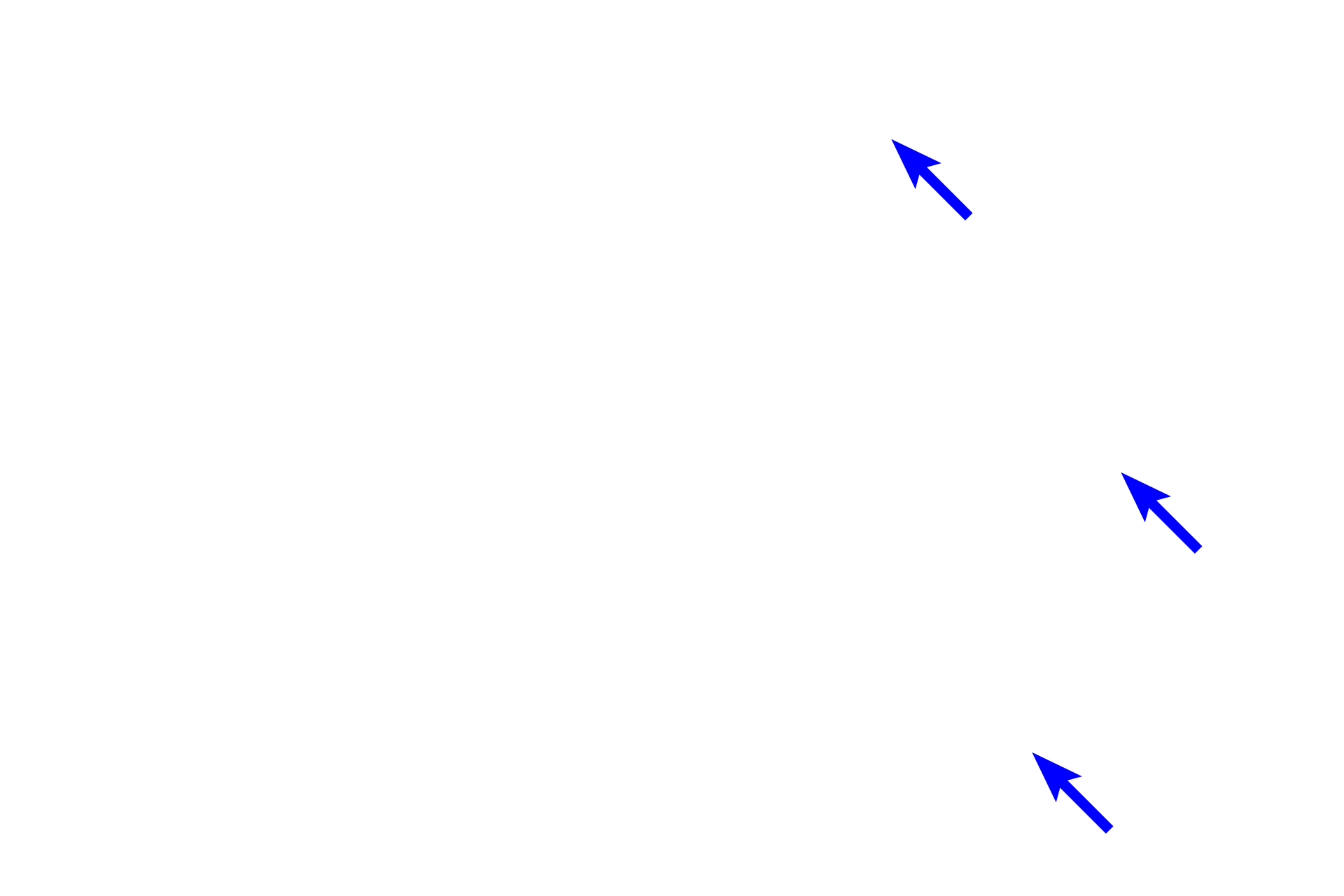  - Central nuclei <p>The myocardium (black, double arrows) is the middle layer of the heart and is composed of cardiac muscle with connective tissue and blood vessels.  The single nucleus of each muscle cell is centrally located, frequently surrounded by a clear space where organelles are located.  In this cross section, the myofibrils can be easily distinguished.  10x, 1000x</p>
