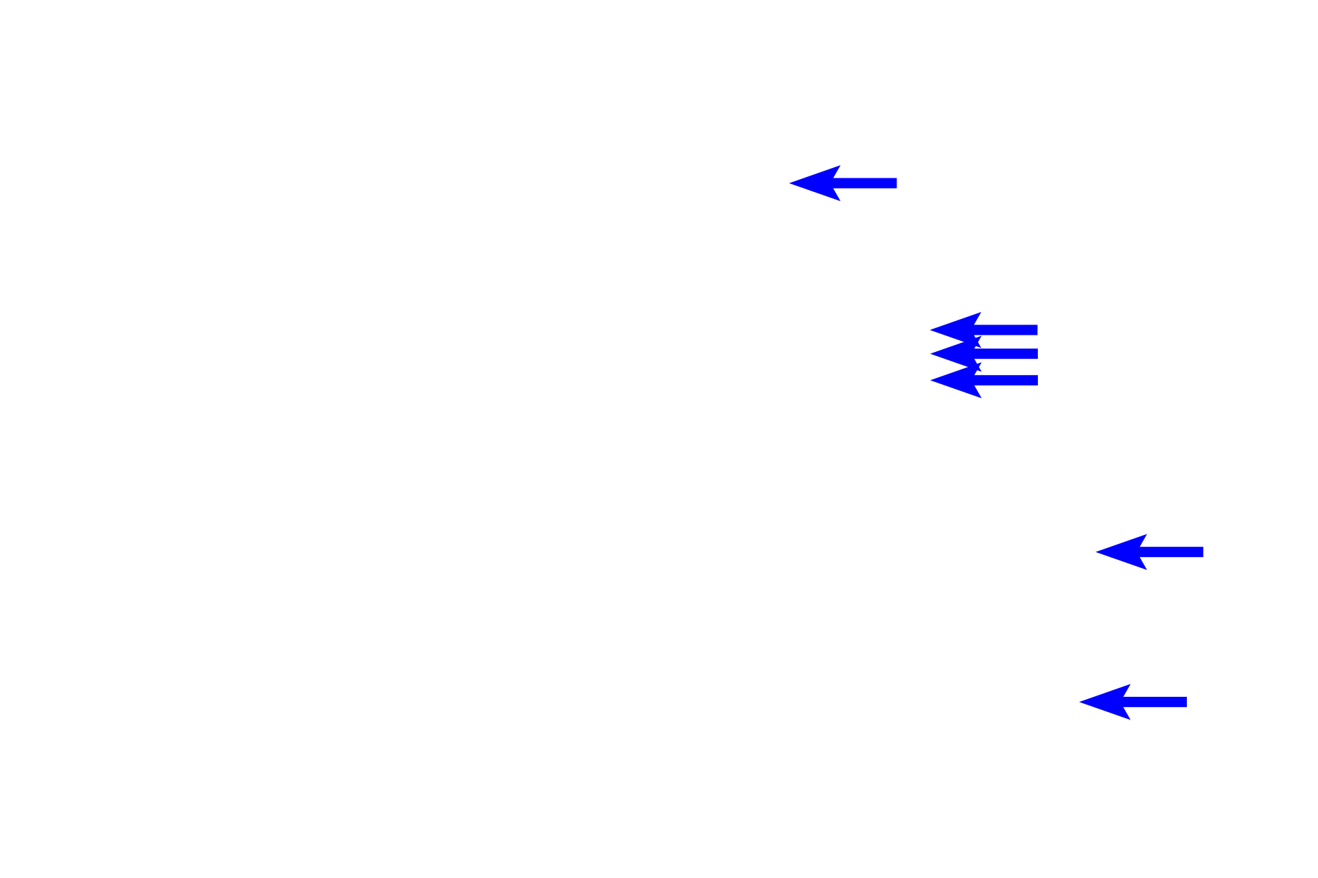  - Myofibrils <p>The myocardium (black, double arrows) is the middle layer of the heart and is composed of cardiac muscle with connective tissue and blood vessels.  The single nucleus of each muscle cell is centrally located, frequently surrounded by a clear space where organelles are located.  In this cross section, the myofibrils can be easily distinguished.  10x, 1000x</p>
