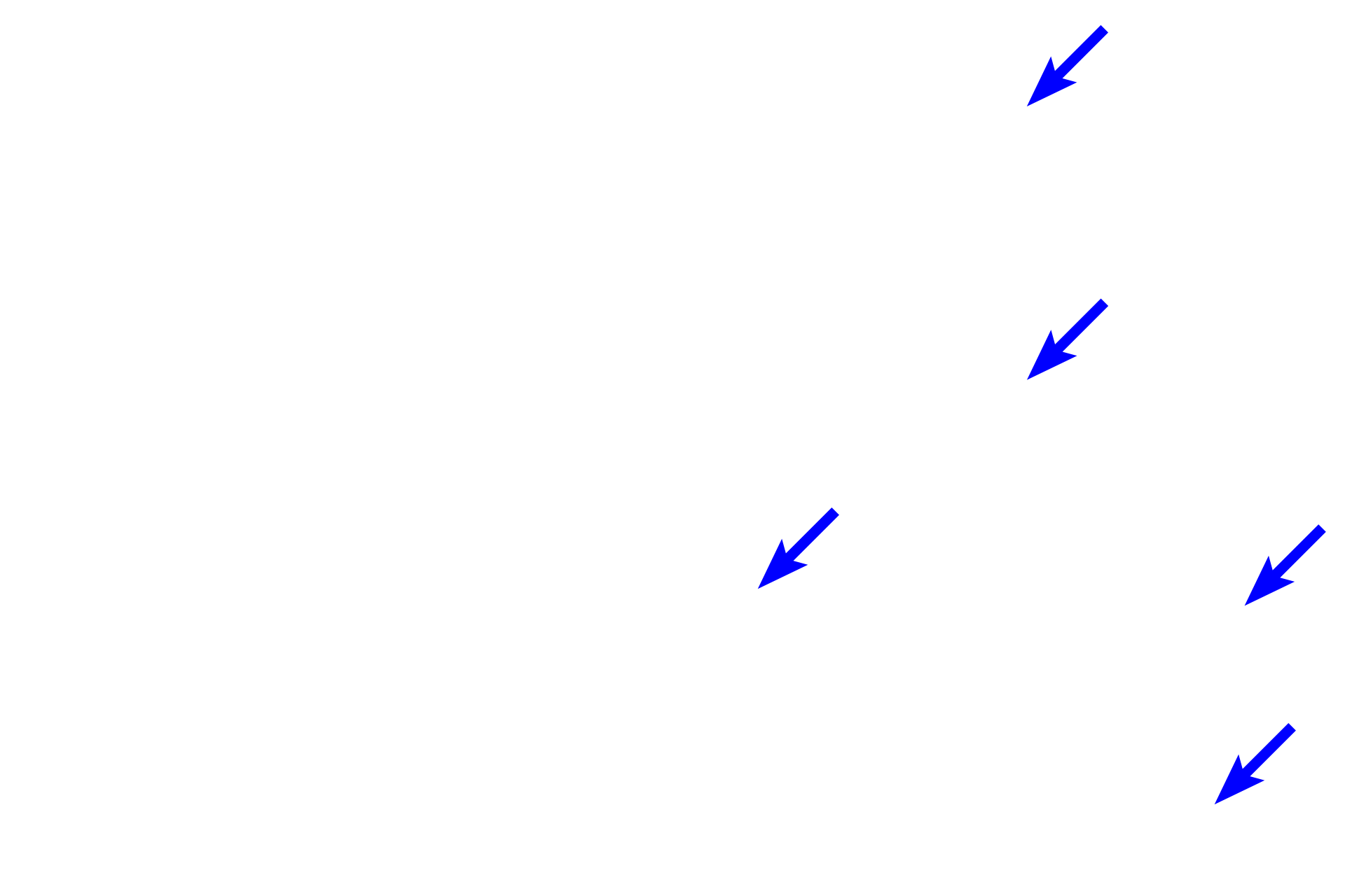 Capillaries <p>The myocardium (black, double arrows) is the middle layer of the heart and is composed of cardiac muscle with connective tissue and blood vessels.  The single nucleus of each muscle cell is centrally located, frequently surrounded by a clear space where organelles are located.  In this cross section, the myofibrils can be easily distinguished.  10x, 1000x</p>

