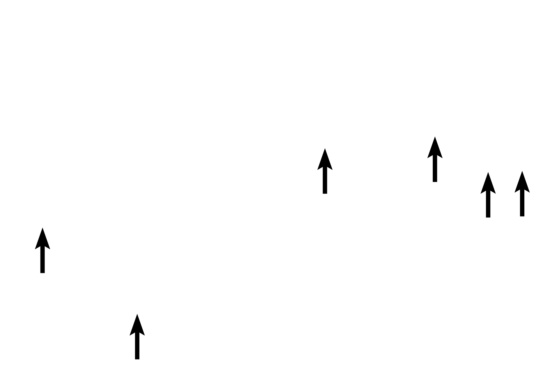 Myofibrils <p>Longitudinal sections of cardiac muscle fibers in the myocardium display intercalated discs and myobrils.  400x, 1000x</p>

