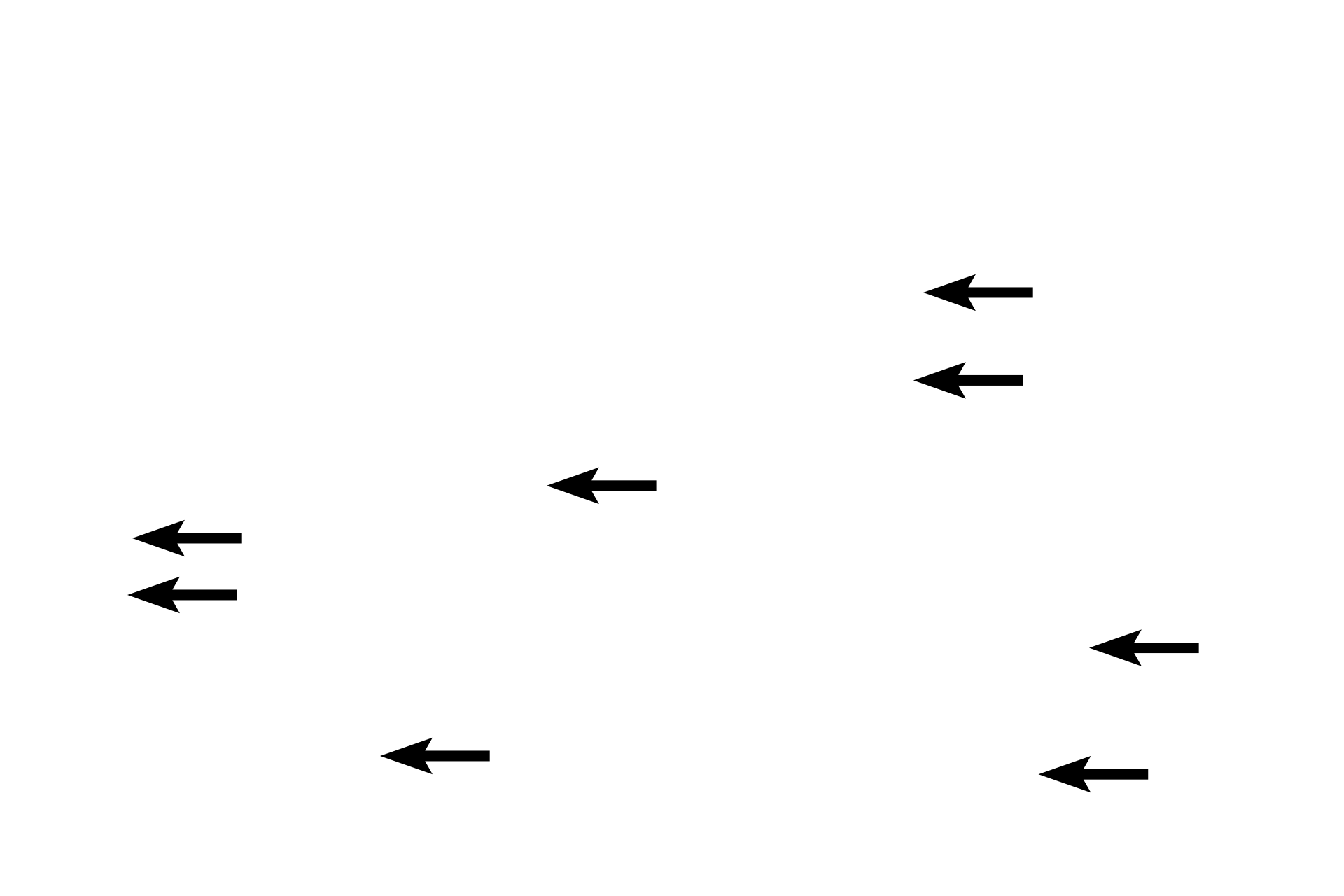 Intercalated discs <p>Longitudinal sections of cardiac muscle fibers in the myocardium display intercalated discs and myobrils.  400x, 1000x</p>
