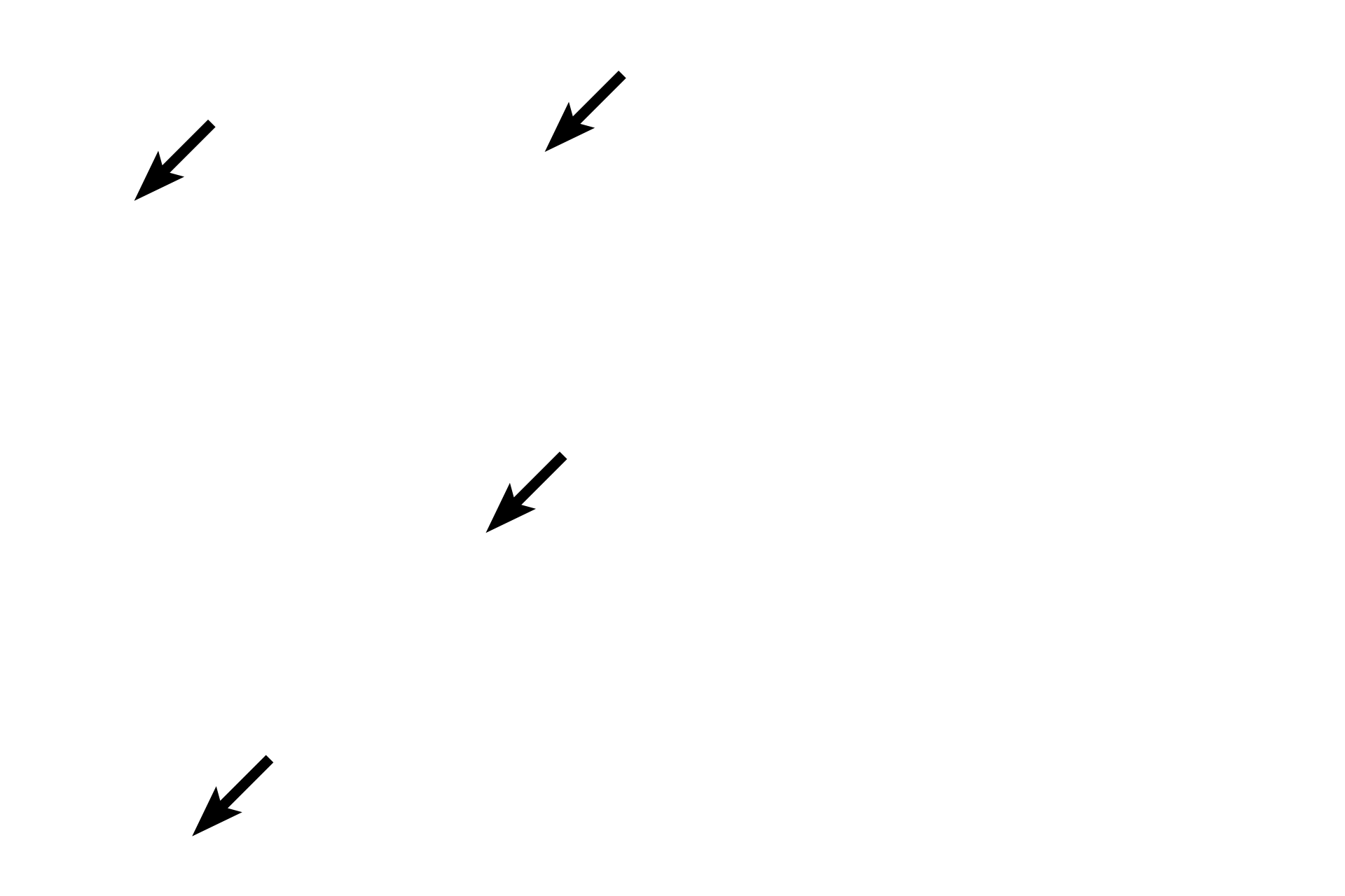 Capillaries <p>Longitudinal sections of cardiac muscle fibers in the myocardium display intercalated discs and myobrils.  400x, 1000x</p>

