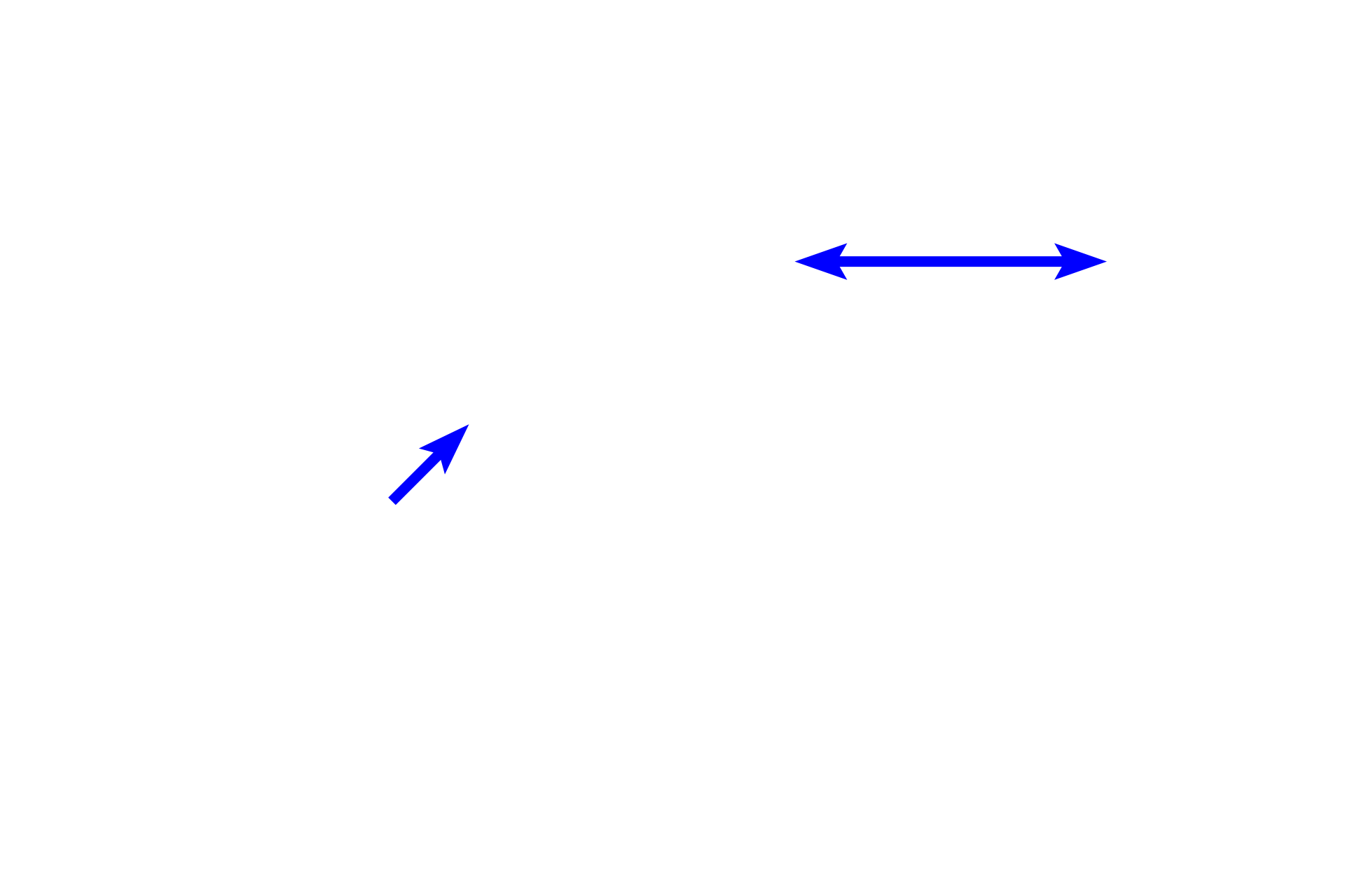  - Coronary artery <p>The epicardium (visceral pericardium, black arrows) is a serous membrane (serosa) of variable thickness, forming the outermost tunic of the heart.  The connective tissue portion of this layer lies adjacent to the myocardium and is covered by a simple squamous epithelium (mesothelium) that faces the pericardial space.  Coronary vessels, nerves and adipocytes are located in this layer.  10x, 100x</p>
